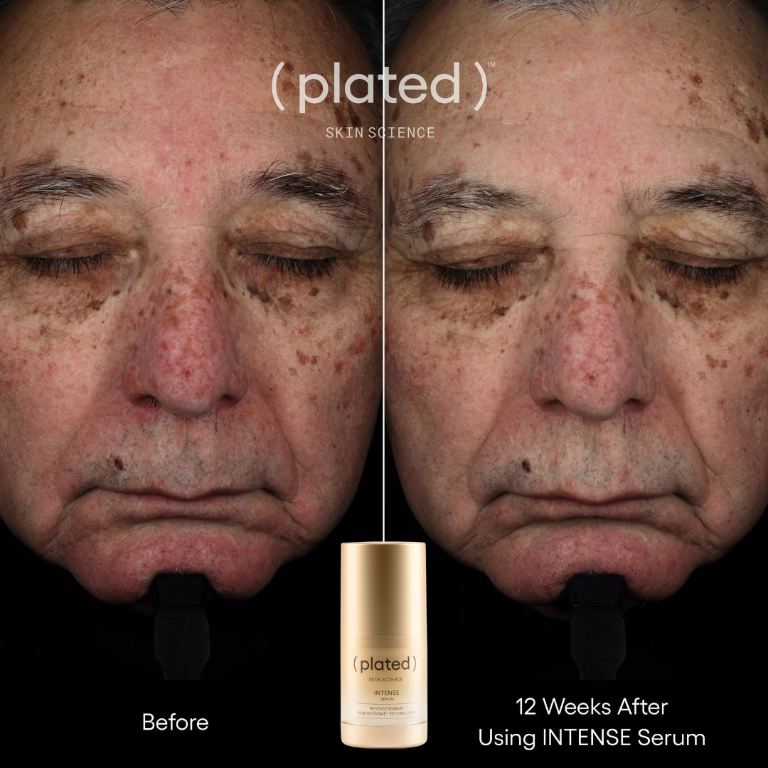 Plated Skin Science Intense Serum bottle with natural ingredients background for skincare and anti-aging