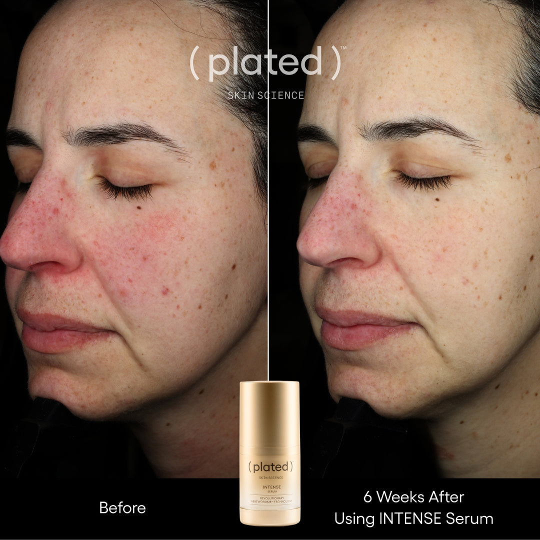 Plated Skin Science Intense Serum bottle with natural ingredients background for skincare and anti-aging