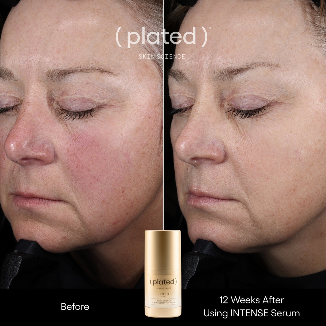 Plated Skin Science Intense Serum bottle with natural ingredients background for skincare and anti-aging