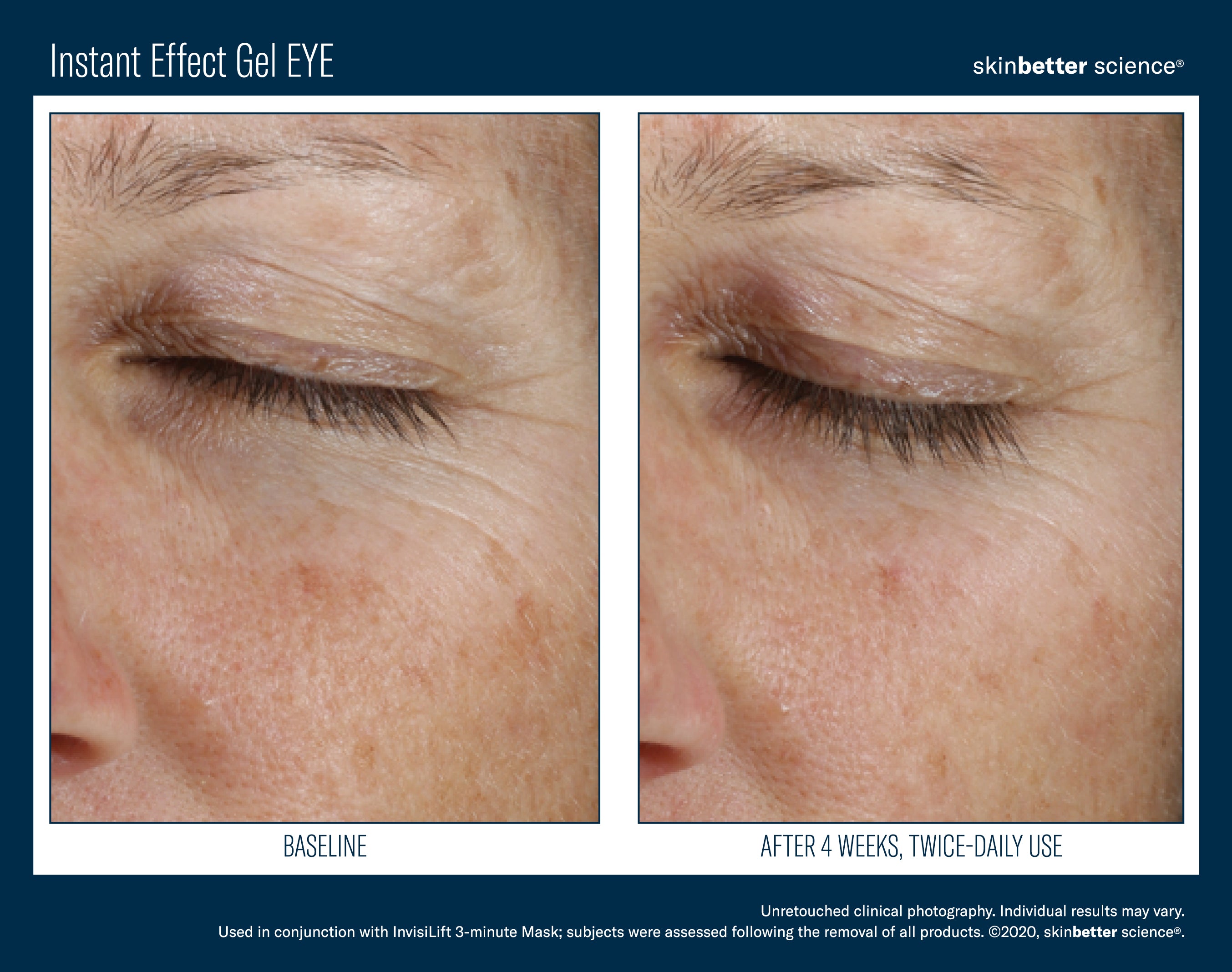SkinBetter Science Instant Effect Gel Eye (0.5 oz).