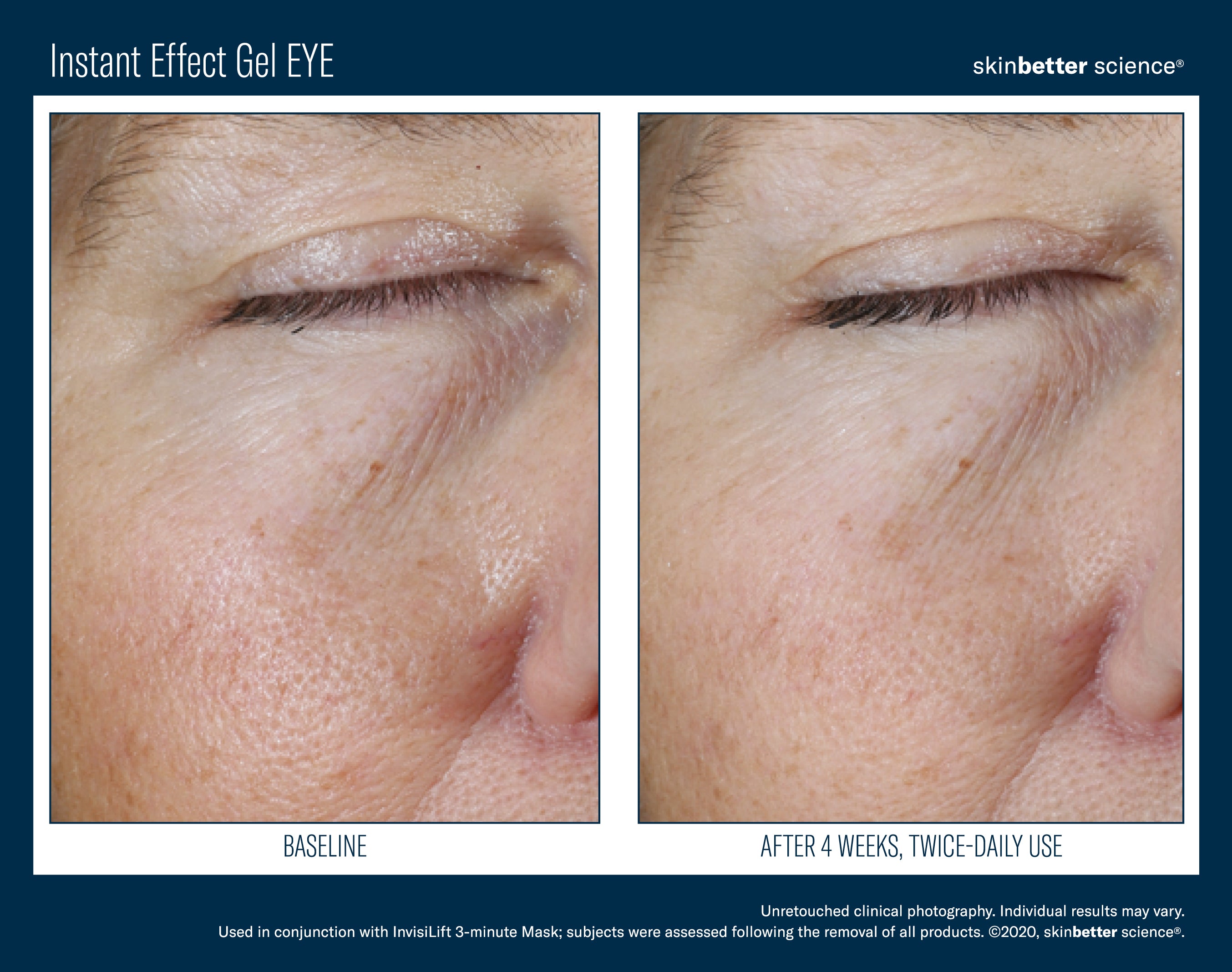 SkinBetter Science Instant Effect Gel Eye (0.5 oz).