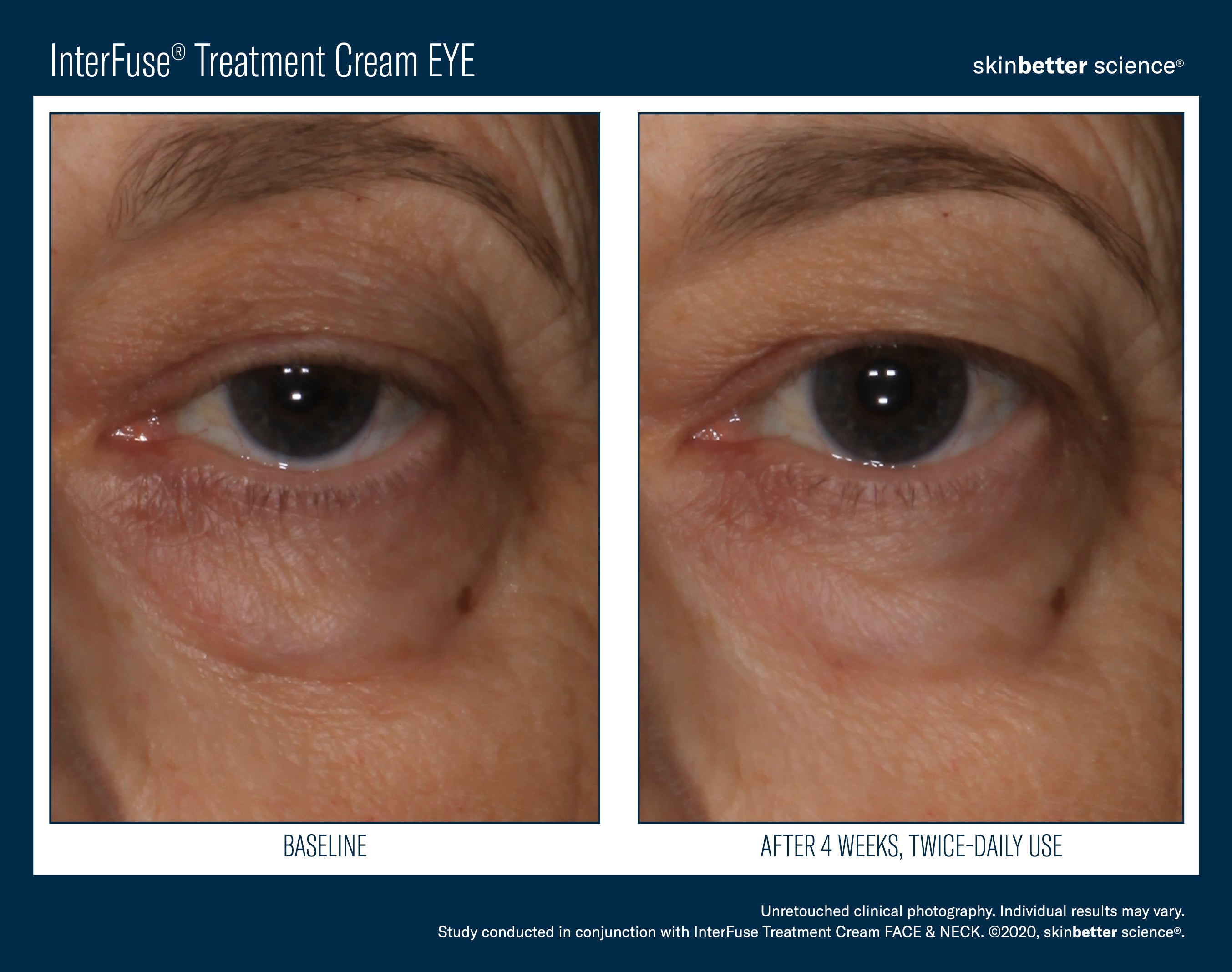 SkinBetter Science InterFuse Treatment Cream Eye (0.5 oz).
