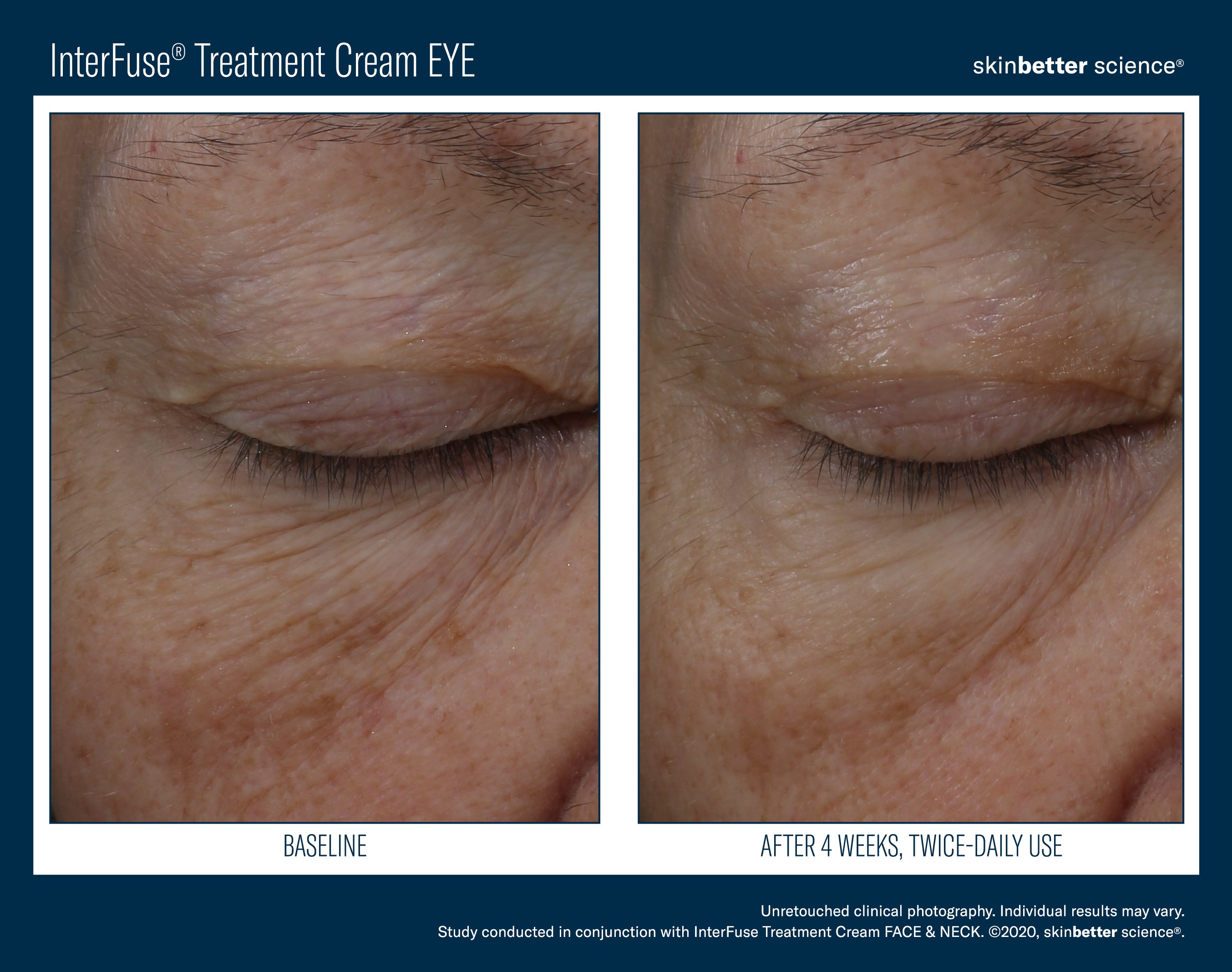 SkinBetter Science InterFuse Treatment Cream Eye (0.5 oz).