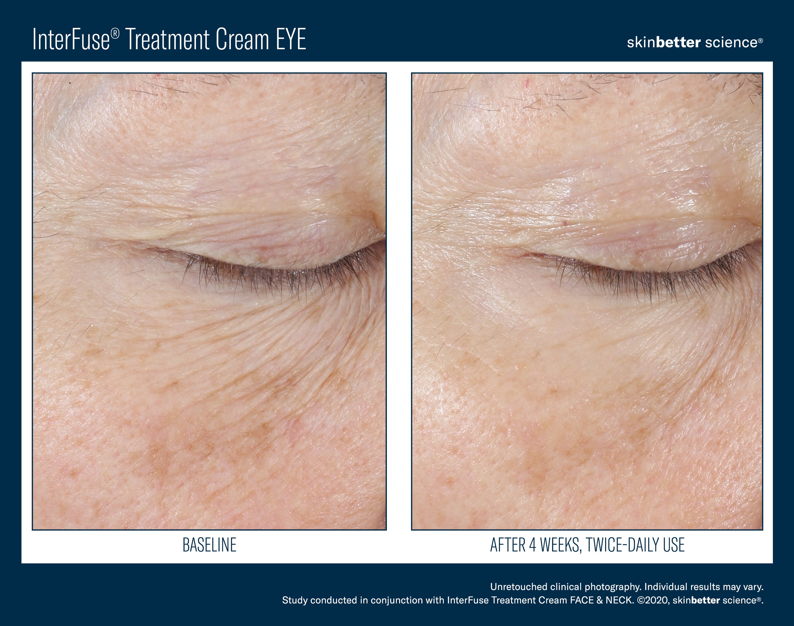 SkinBetter Science InterFuse Treatment Cream Eye (0.5 oz).