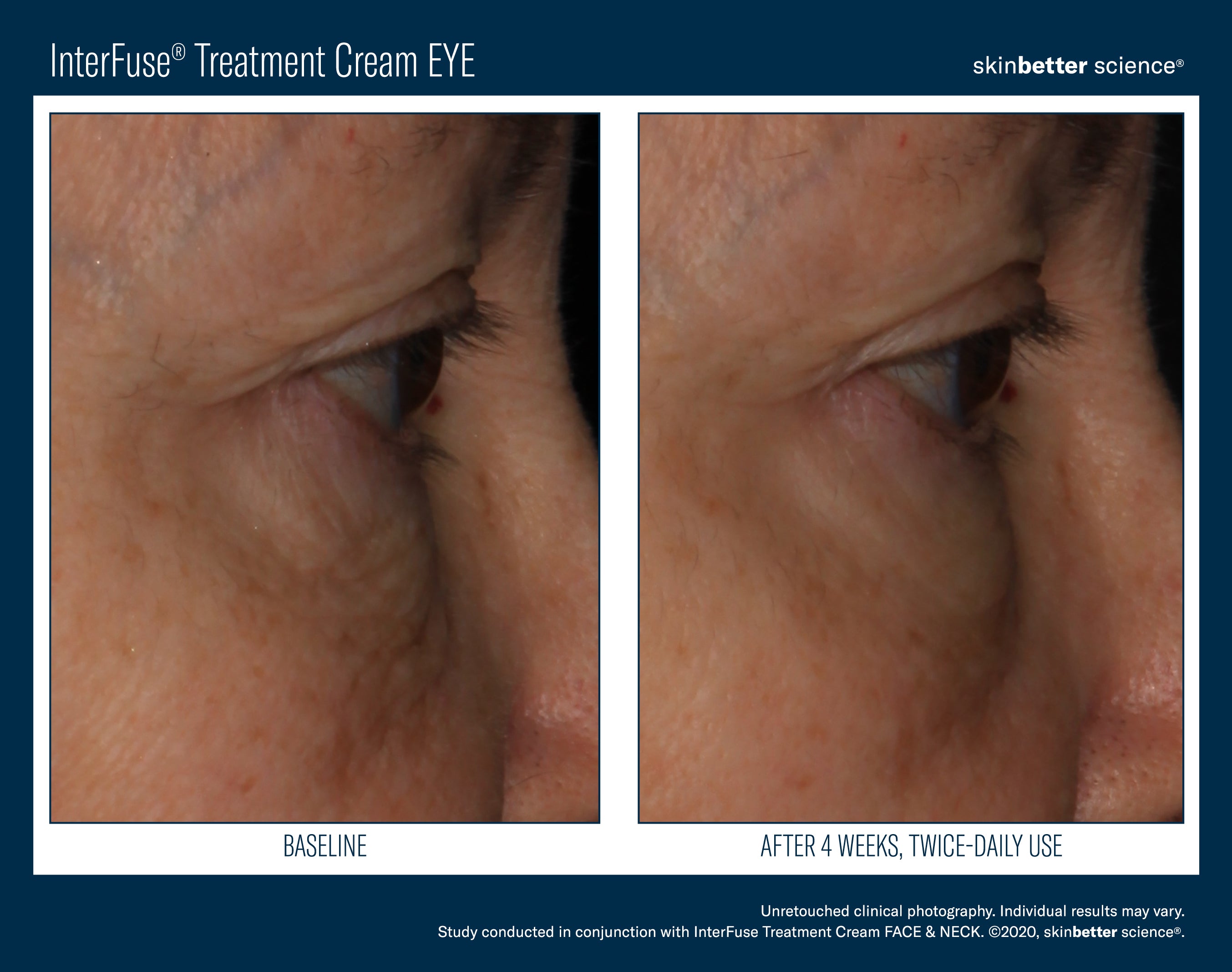 SkinBetter Science InterFuse Treatment Cream Eye (0.5 oz).