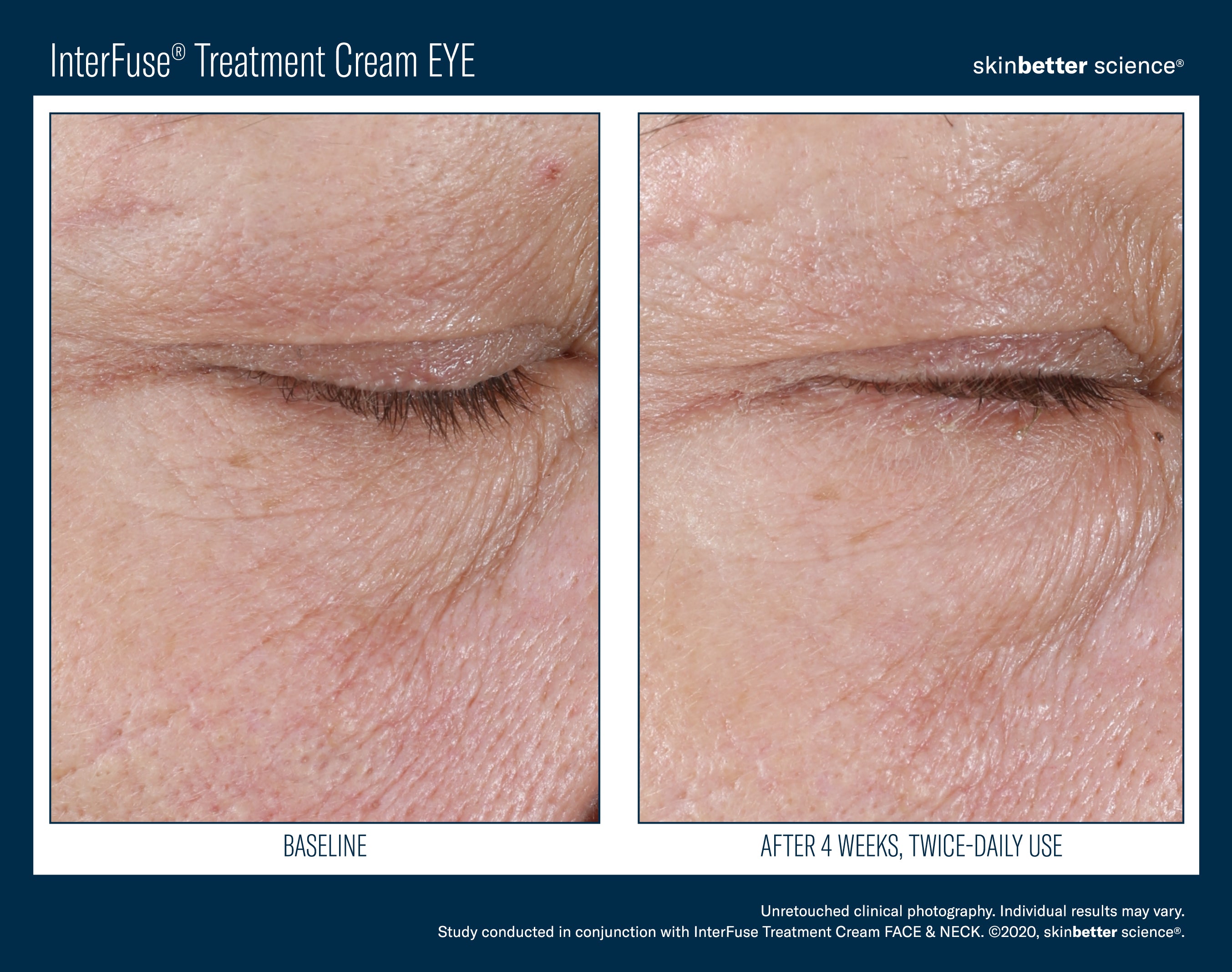 SkinBetter Science InterFuse Treatment Cream Eye (0.5 oz).