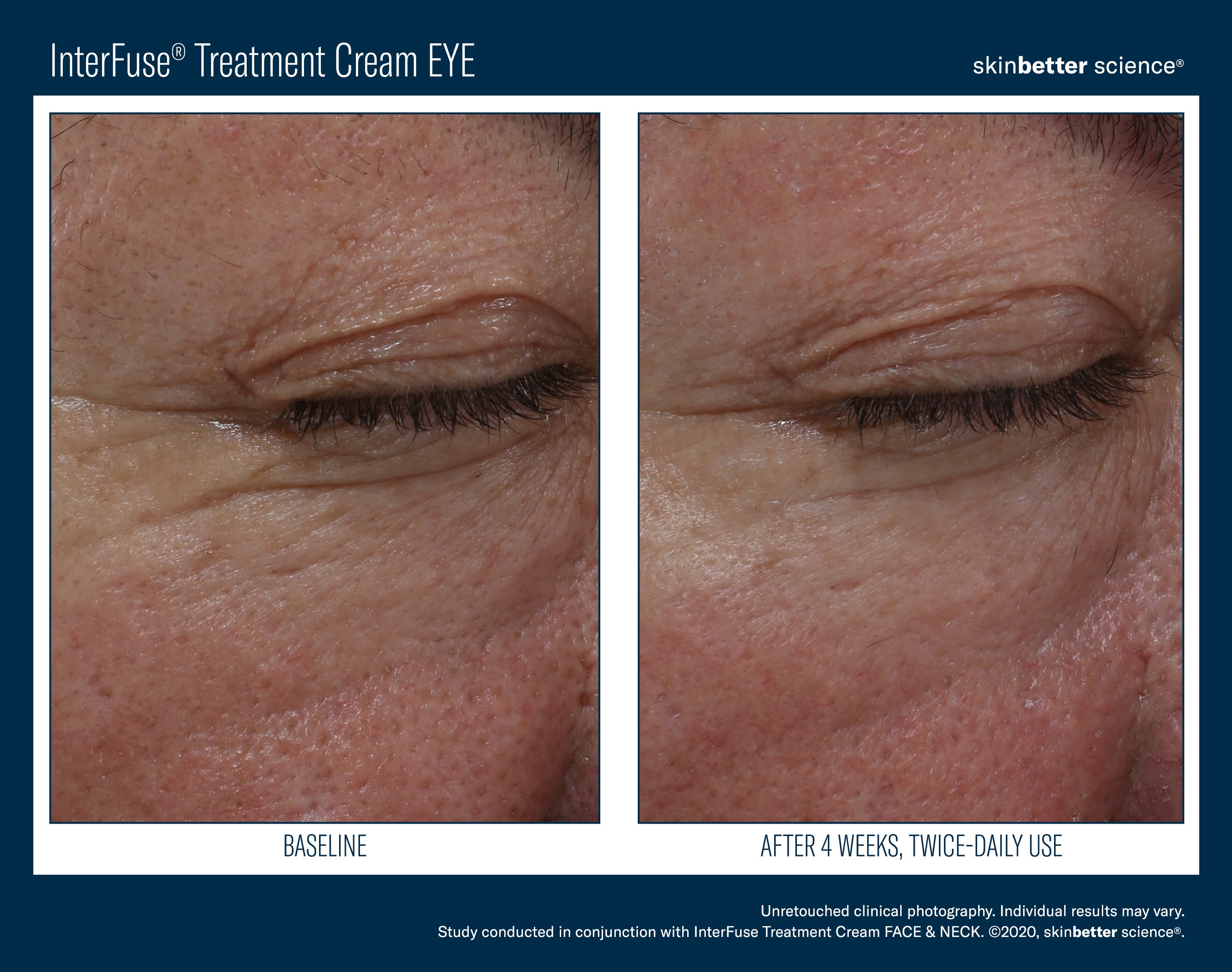 SkinBetter Science InterFuse Treatment Cream Eye (0.5 oz).