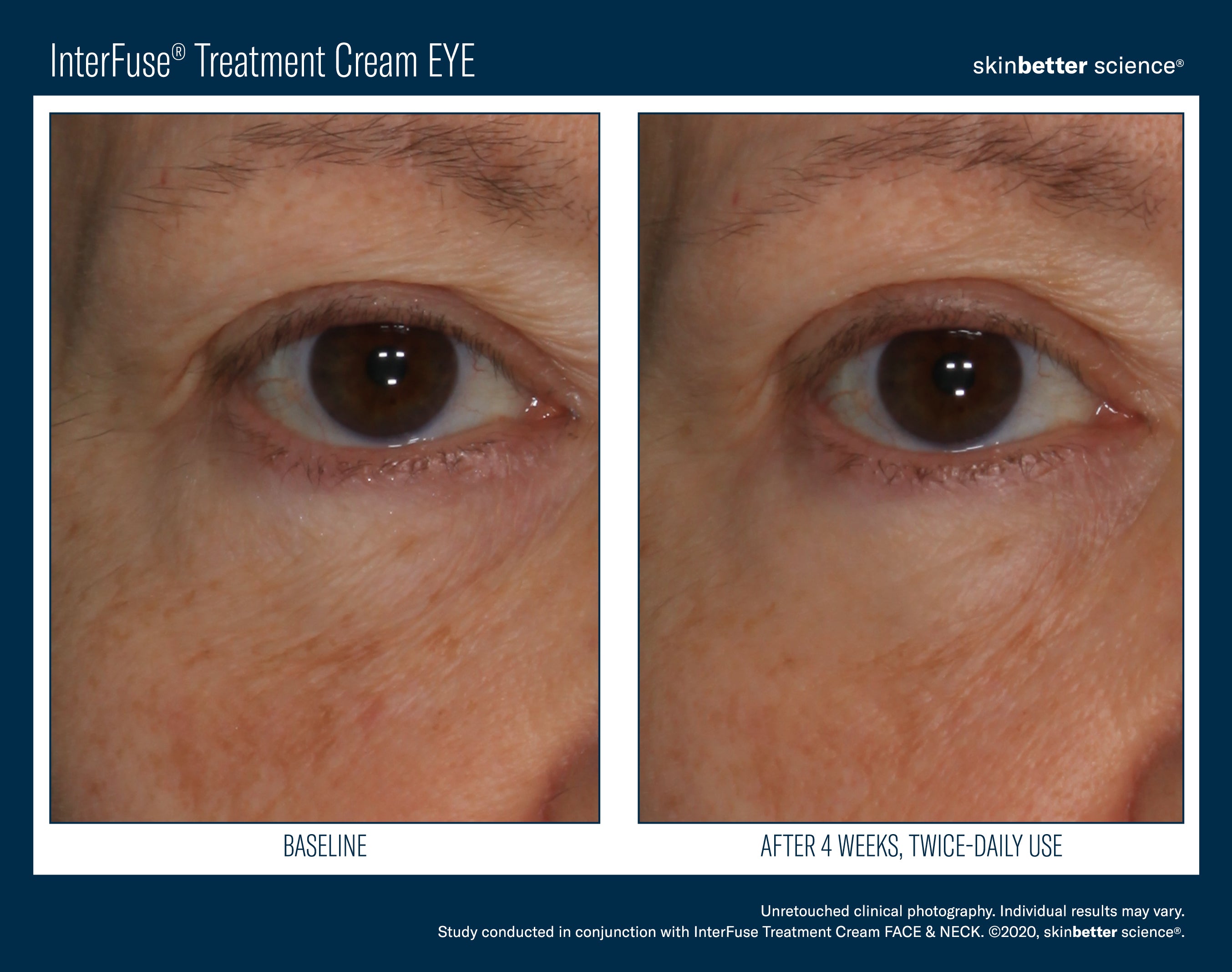 SkinBetter Science InterFuse Treatment Cream Eye (0.5 oz).