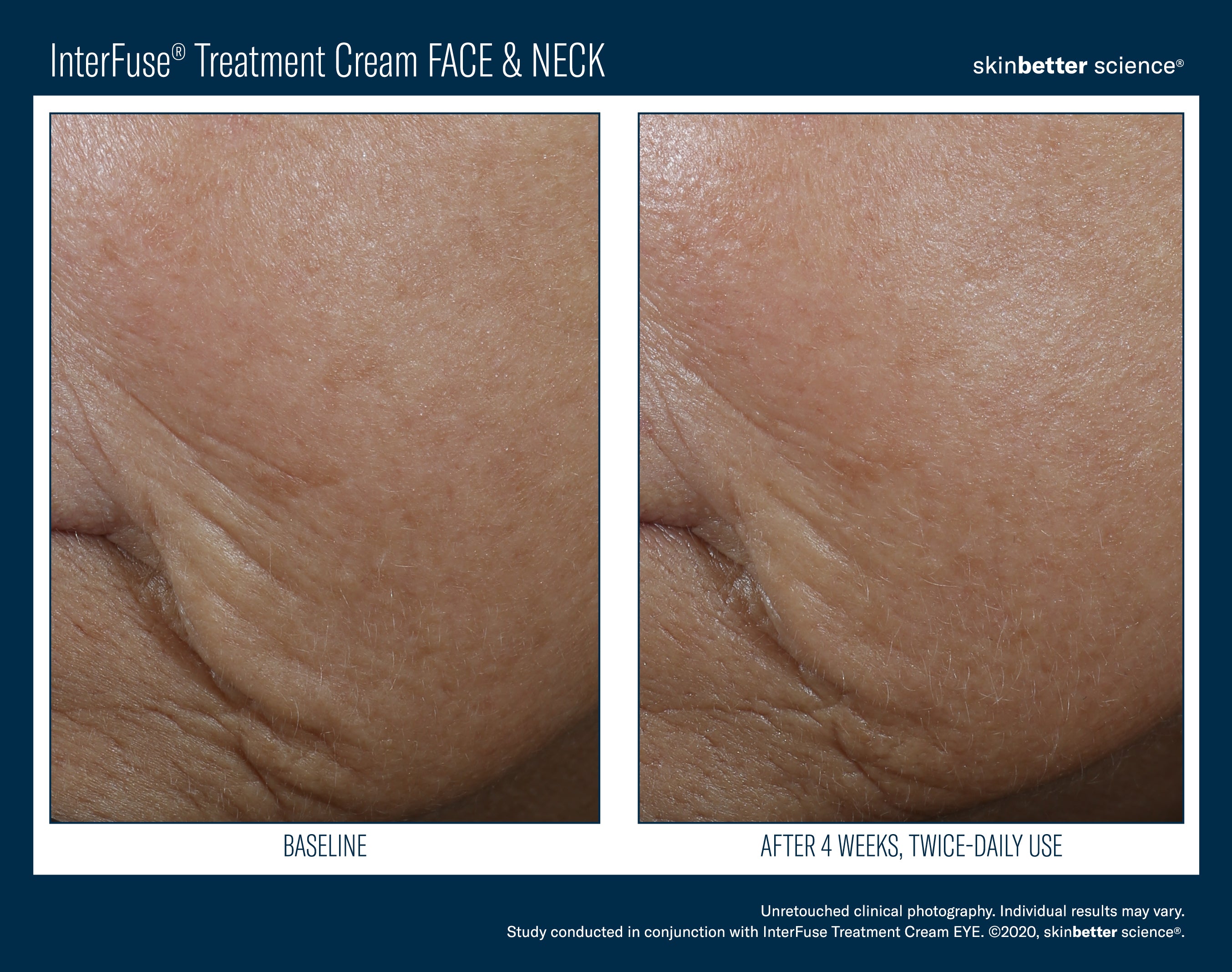 SkinBetter Science InterFuse Treatment Cream Face & Neck (1 oz).