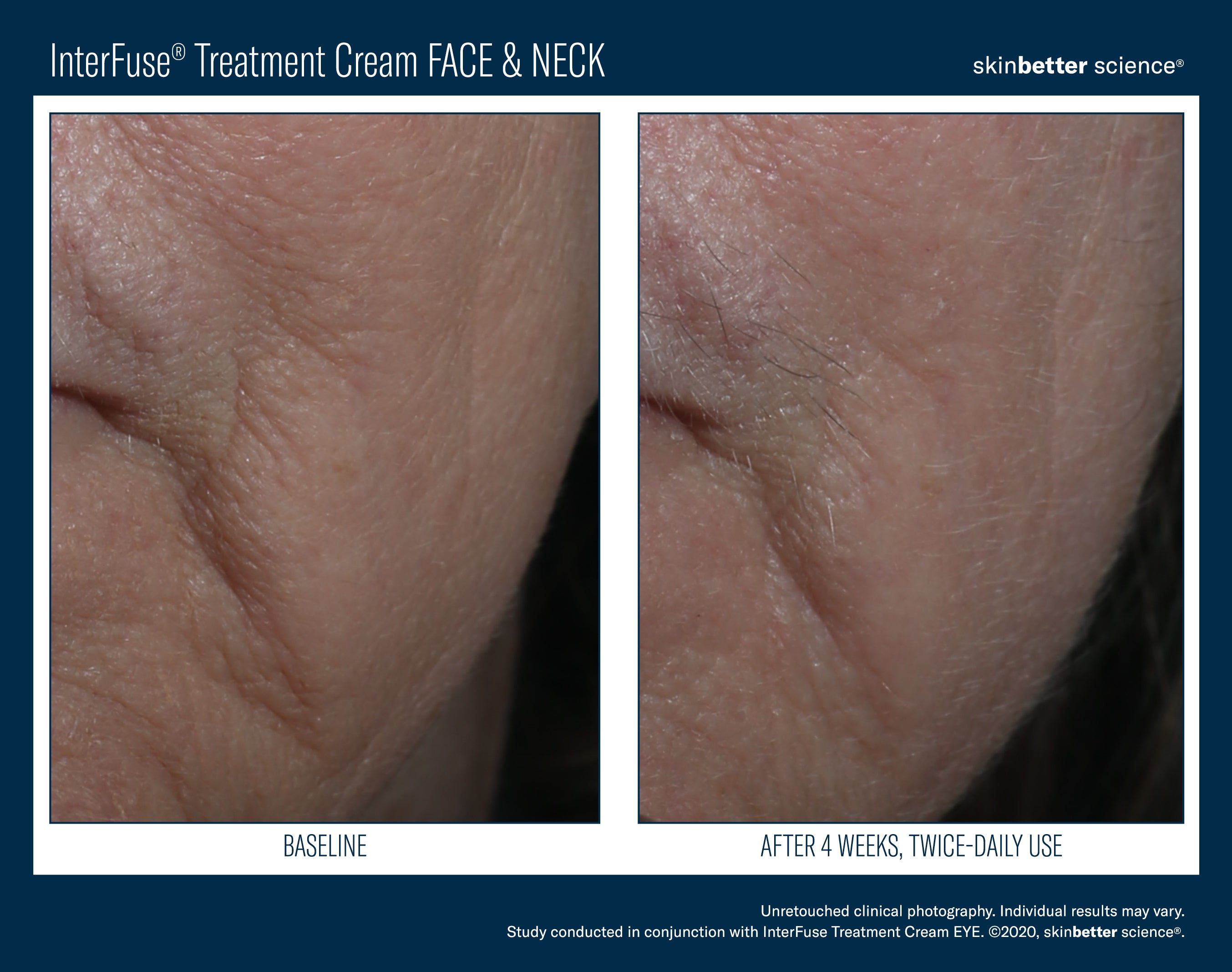 SkinBetter Science InterFuse Treatment Cream Face & Neck (1.69 oz).