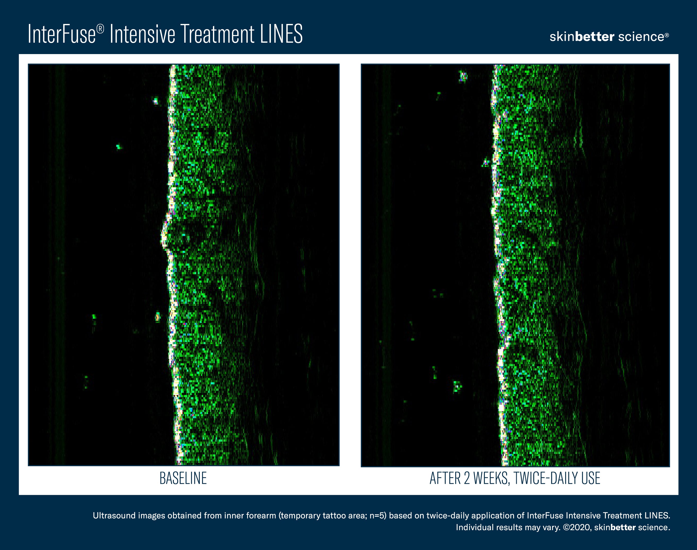 SkinBetter Science InterFuse Intensive Treatment Lines (1 oz).
