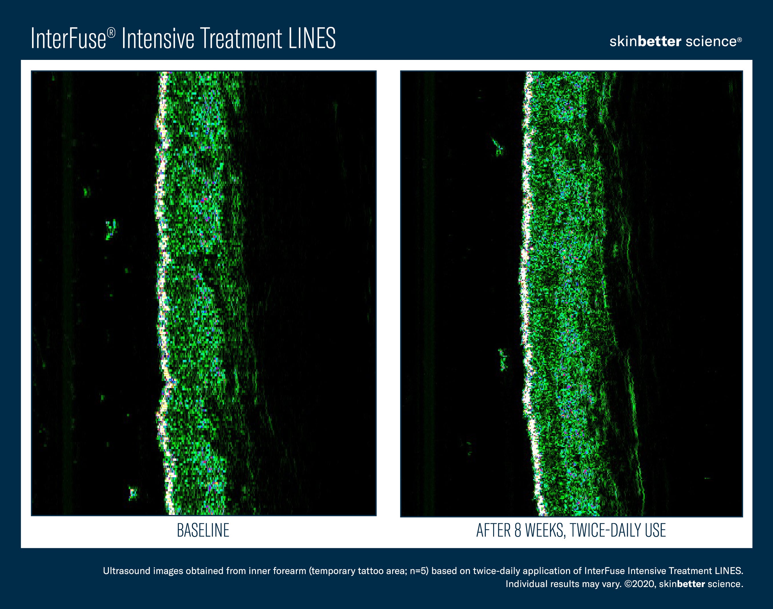 SkinBetter Science InterFuse Intensive Treatment Lines (1 oz).