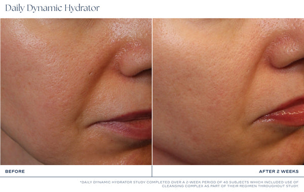 iS Clinical Daily Dynamic Hydrator (1.7 oz)