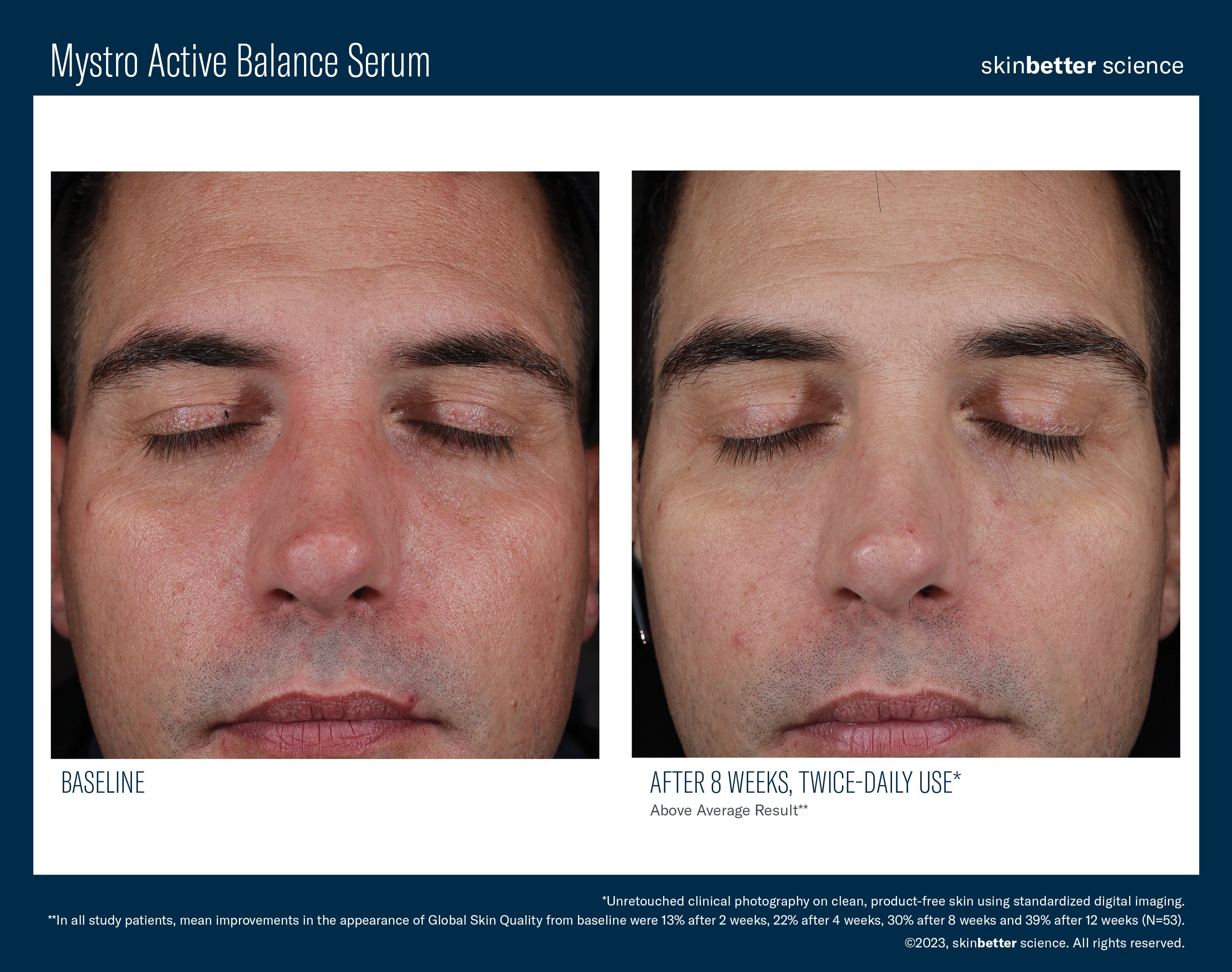 SkinBetter Science Mystro Active Balance Serum (1.7 oz)