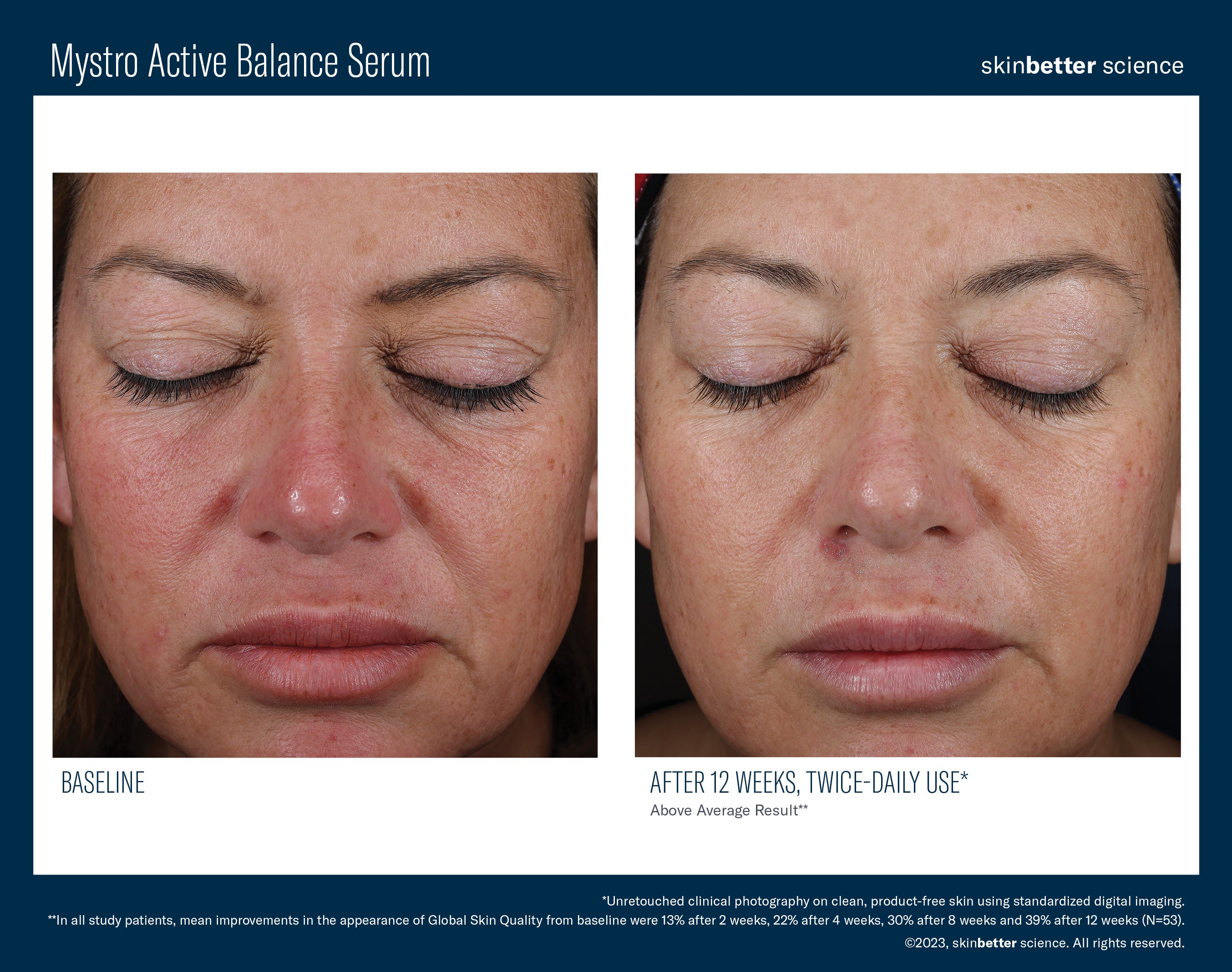 SkinBetter Science Mystro Active Balance Serum (0.5 oz)