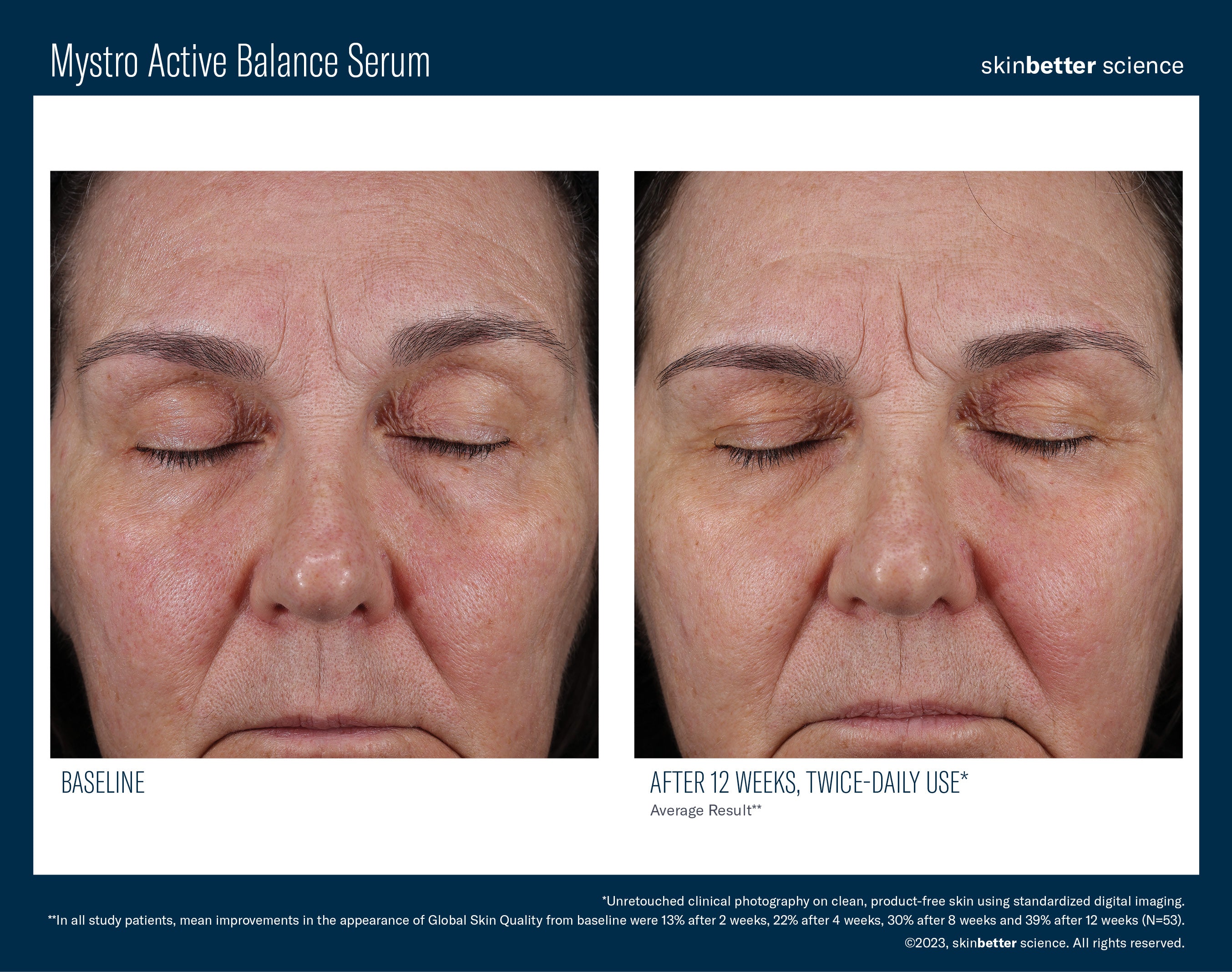 SkinBetter Science Mystro Active Balance Serum (1 oz)