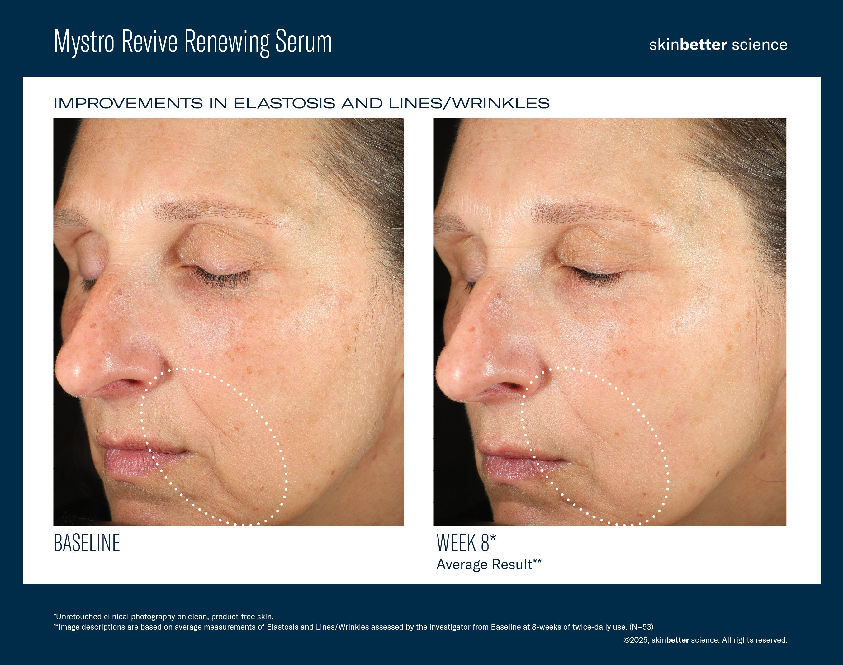 SkinBetter Science Mystro Revive Renewing Serum (1 oz)