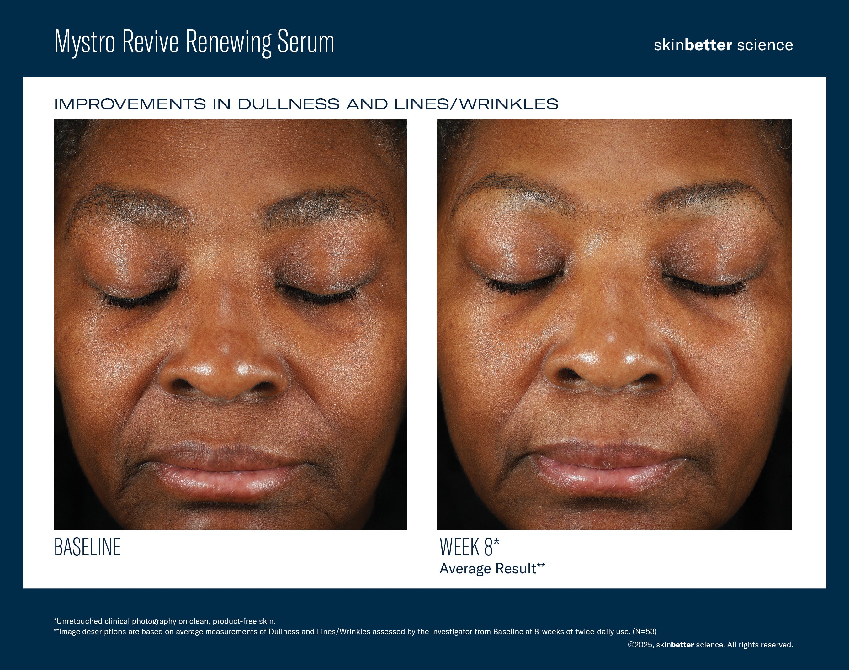 SkinBetter Science Mystro Revive Renewing Serum (1 oz)