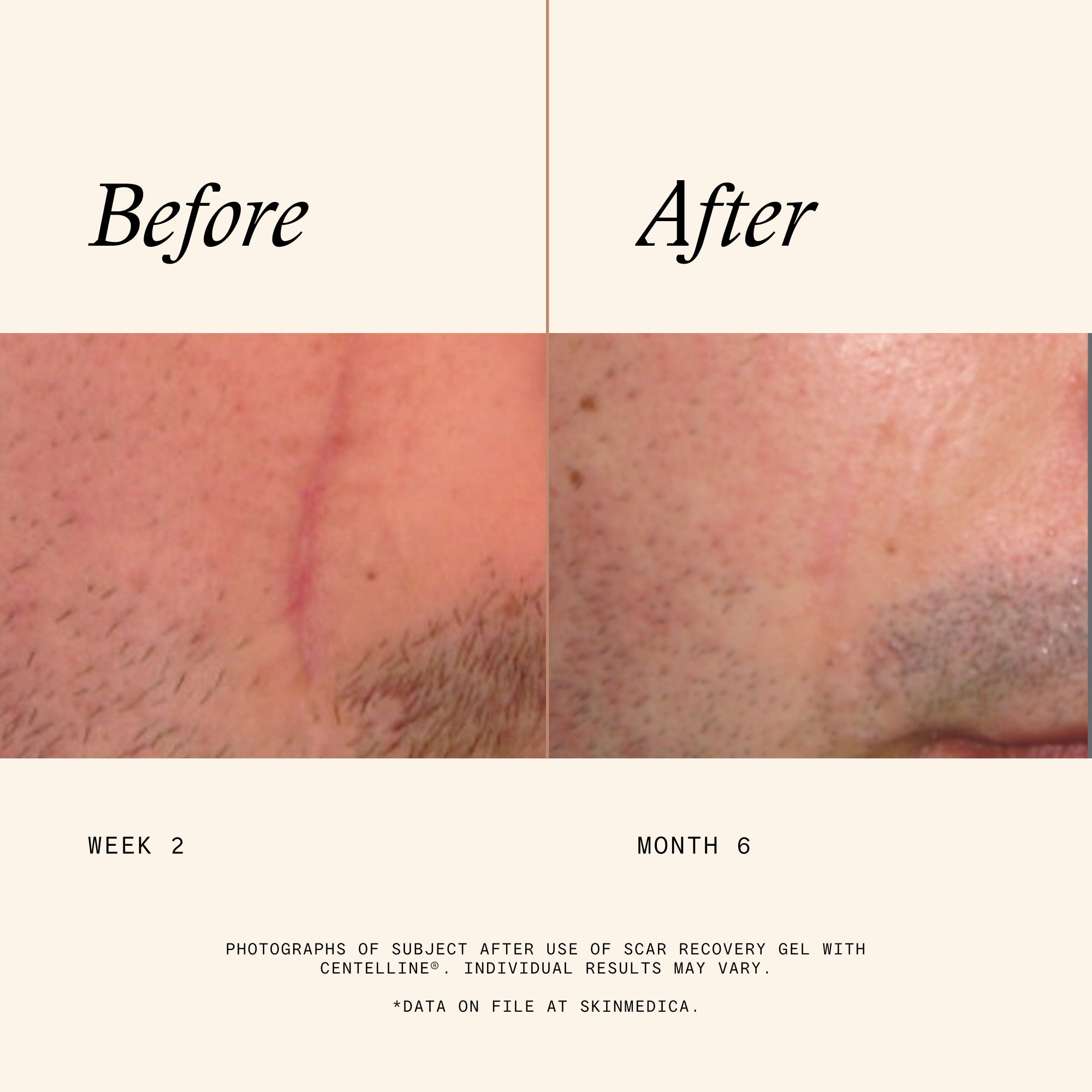 SkinMedica Scar Recovery Gel with Centelline (2 oz)