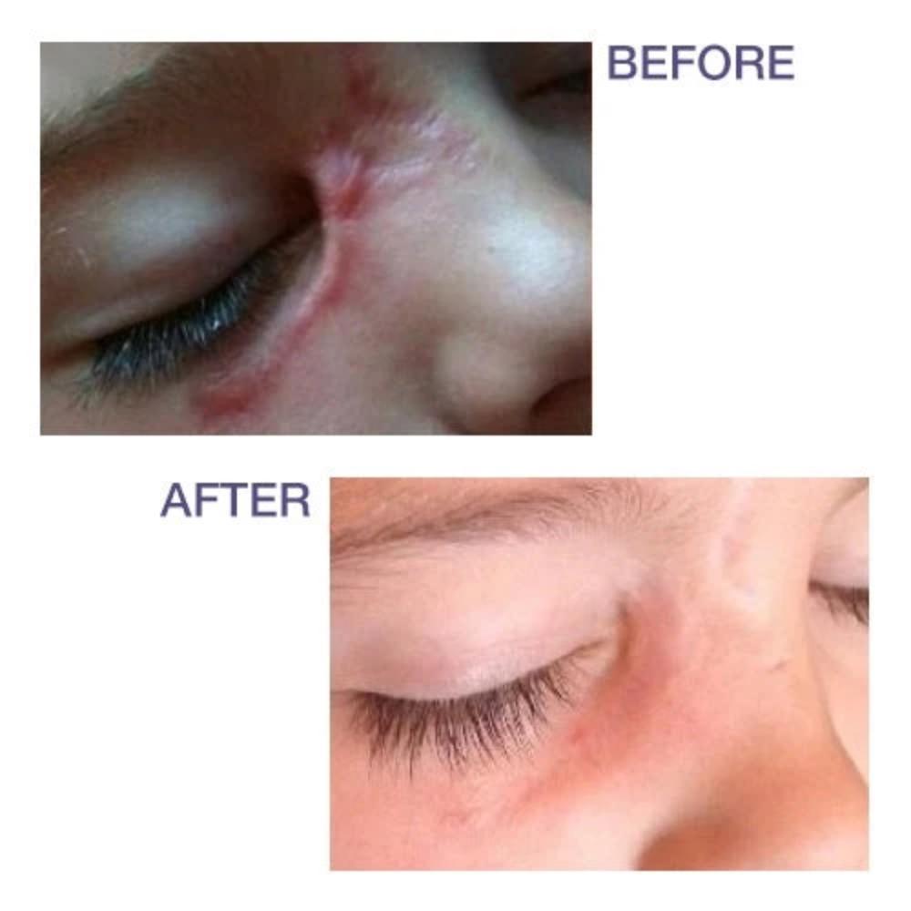 Biodermis Pro-Sil 17g