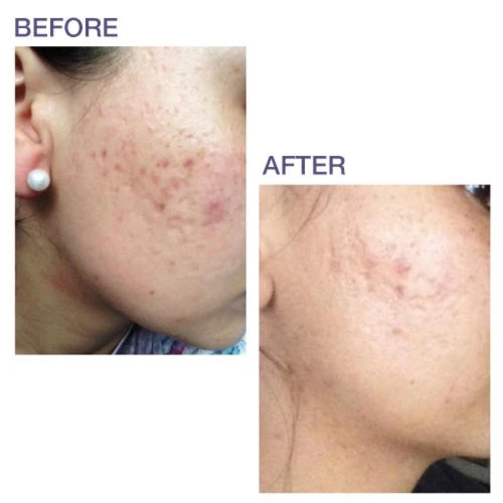 Biodermis Pro-Sil 17g