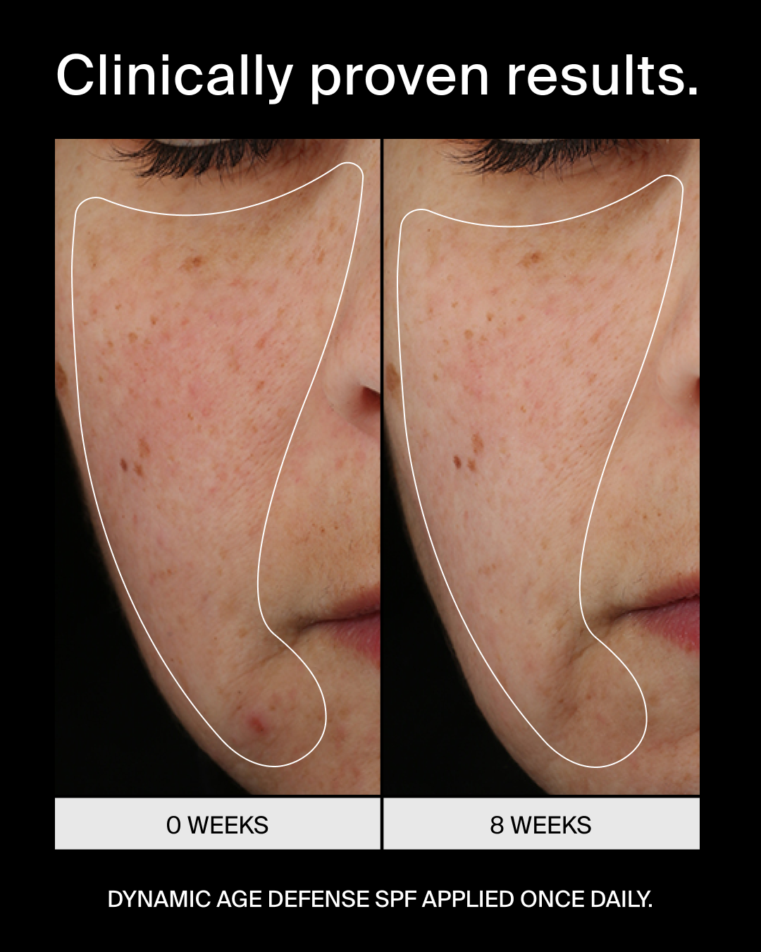 Pavise Dynamic Age Defense SPF 30 Refill (1 oz)