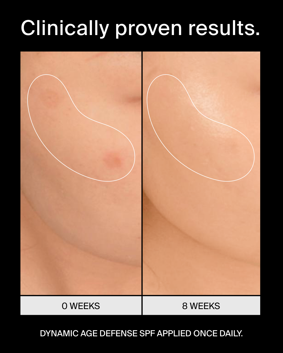 Pavise Dynamic Age Defense SPF 30 Refill (1 oz)