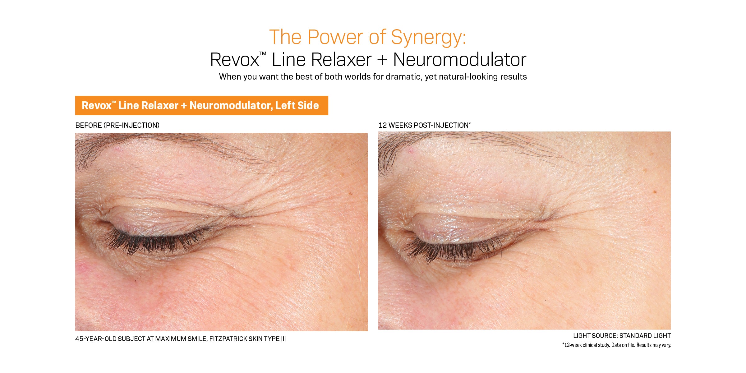 Revision Skincare Revox™ Line Relaxer (0.68 oz).