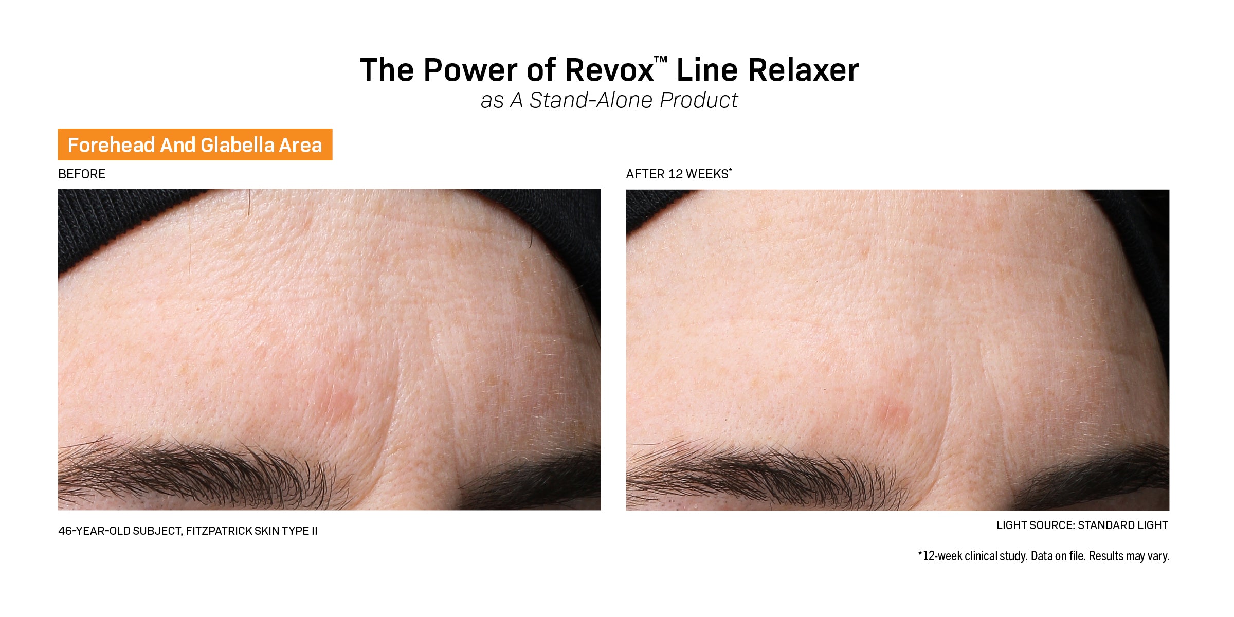 Revision Skincare Revox™ Line Relaxer (0.68 oz).