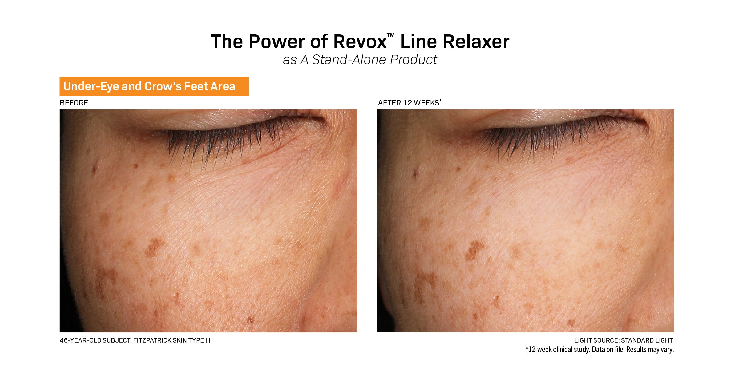 Revision Skincare Revox™ Line Relaxer (0.68 oz).