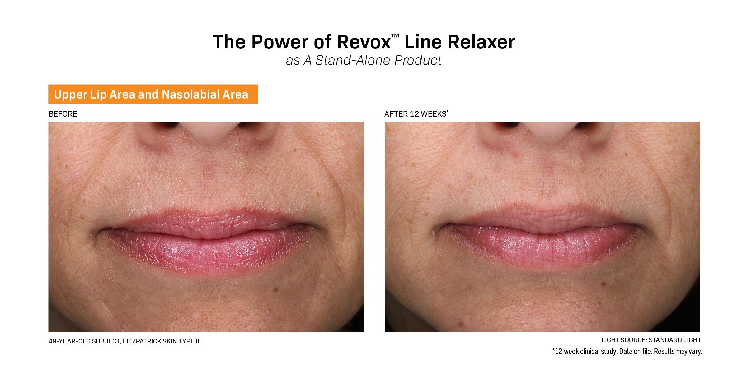 Revision Skincare Revox™ Line Relaxer (0.68 oz).