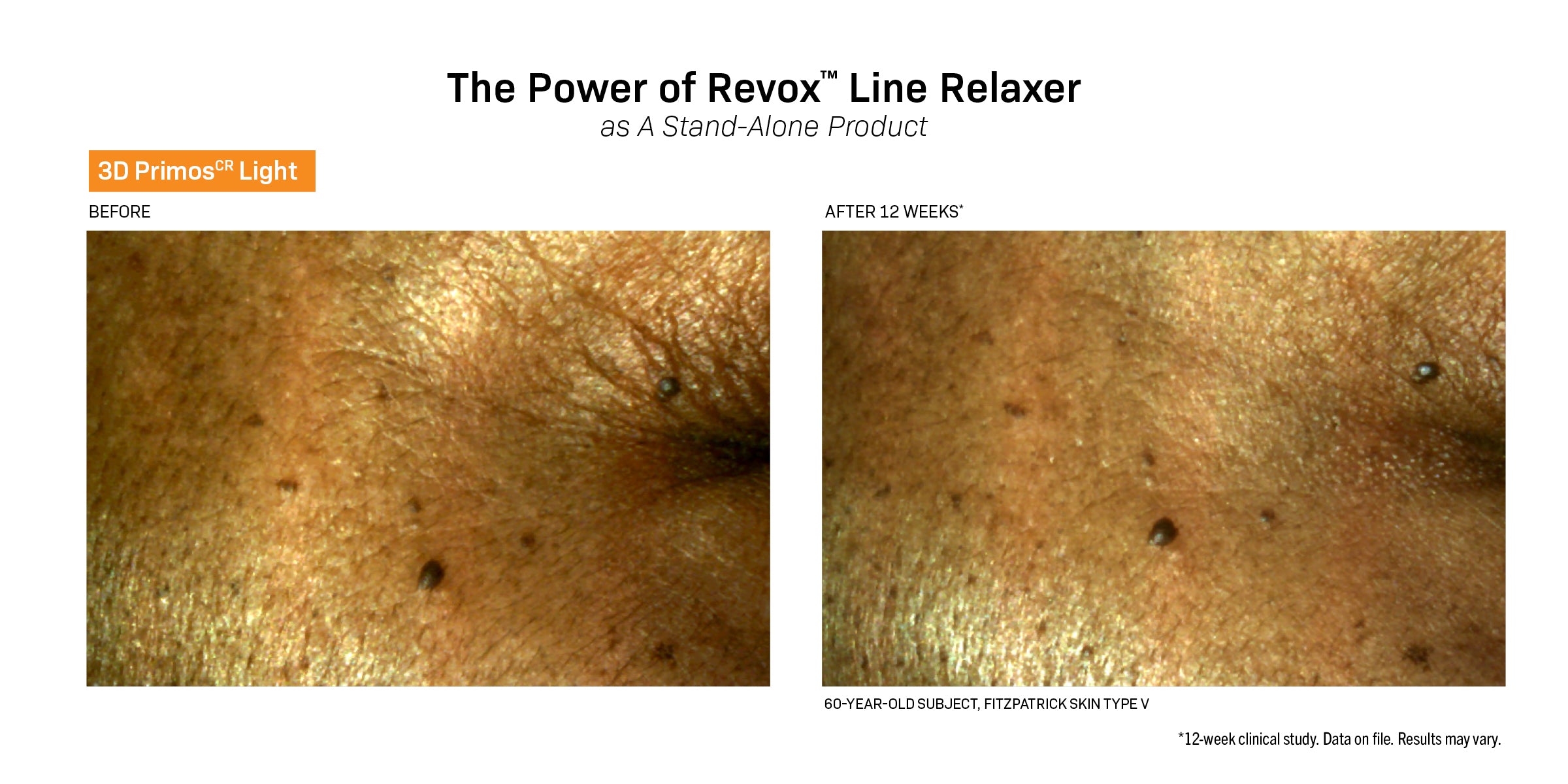 Revision Skincare Revox™ Line Relaxer (0.68 oz).
