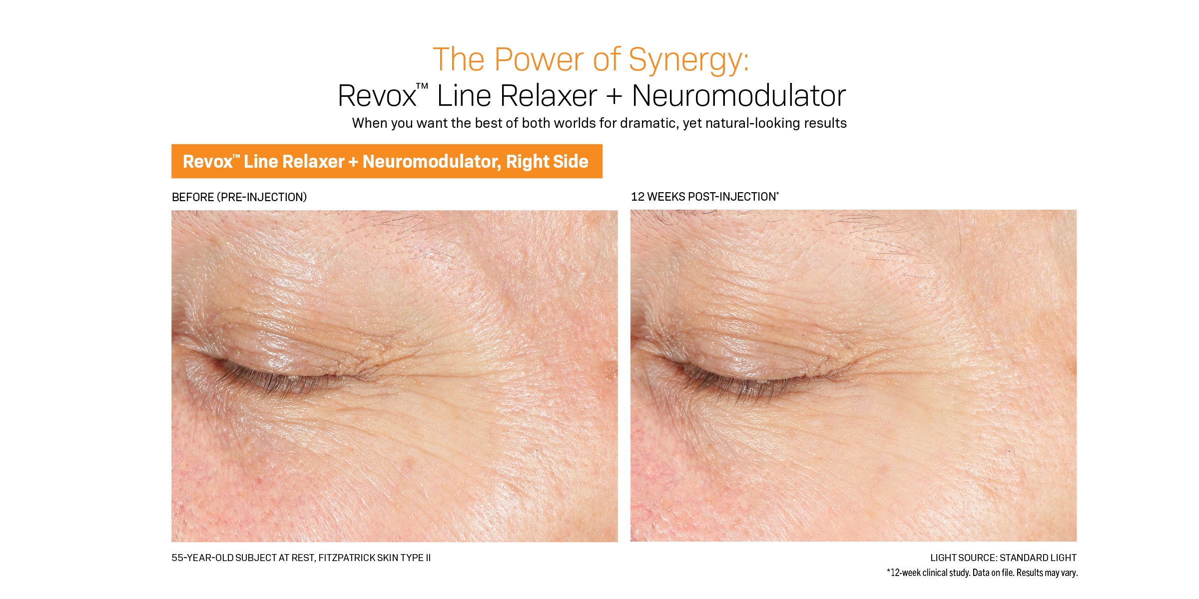 Revision Skincare Revox™ Line Relaxer (0.68 oz).