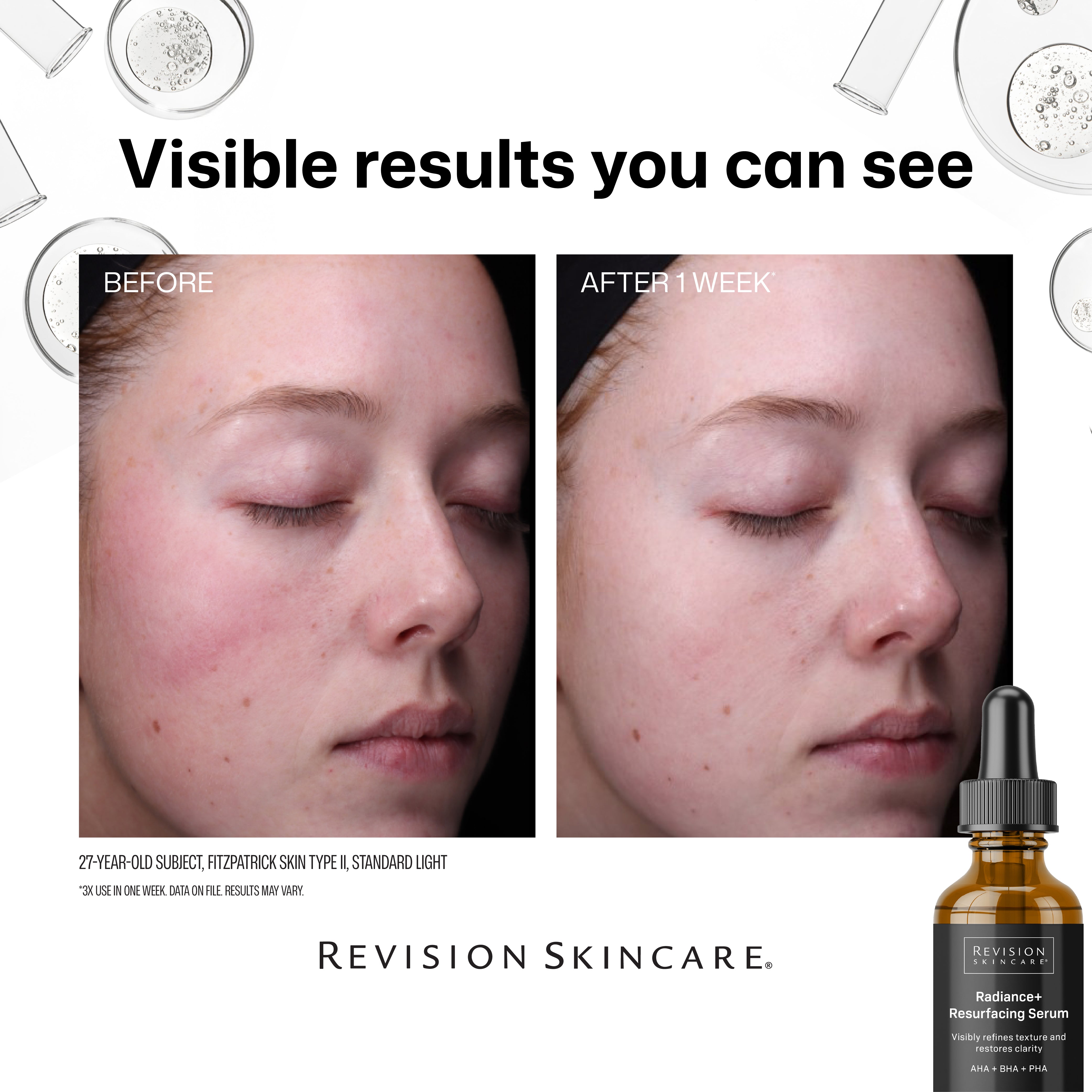 Revision Skincare Radiance+ Resurfacing Serum (1 oz).
