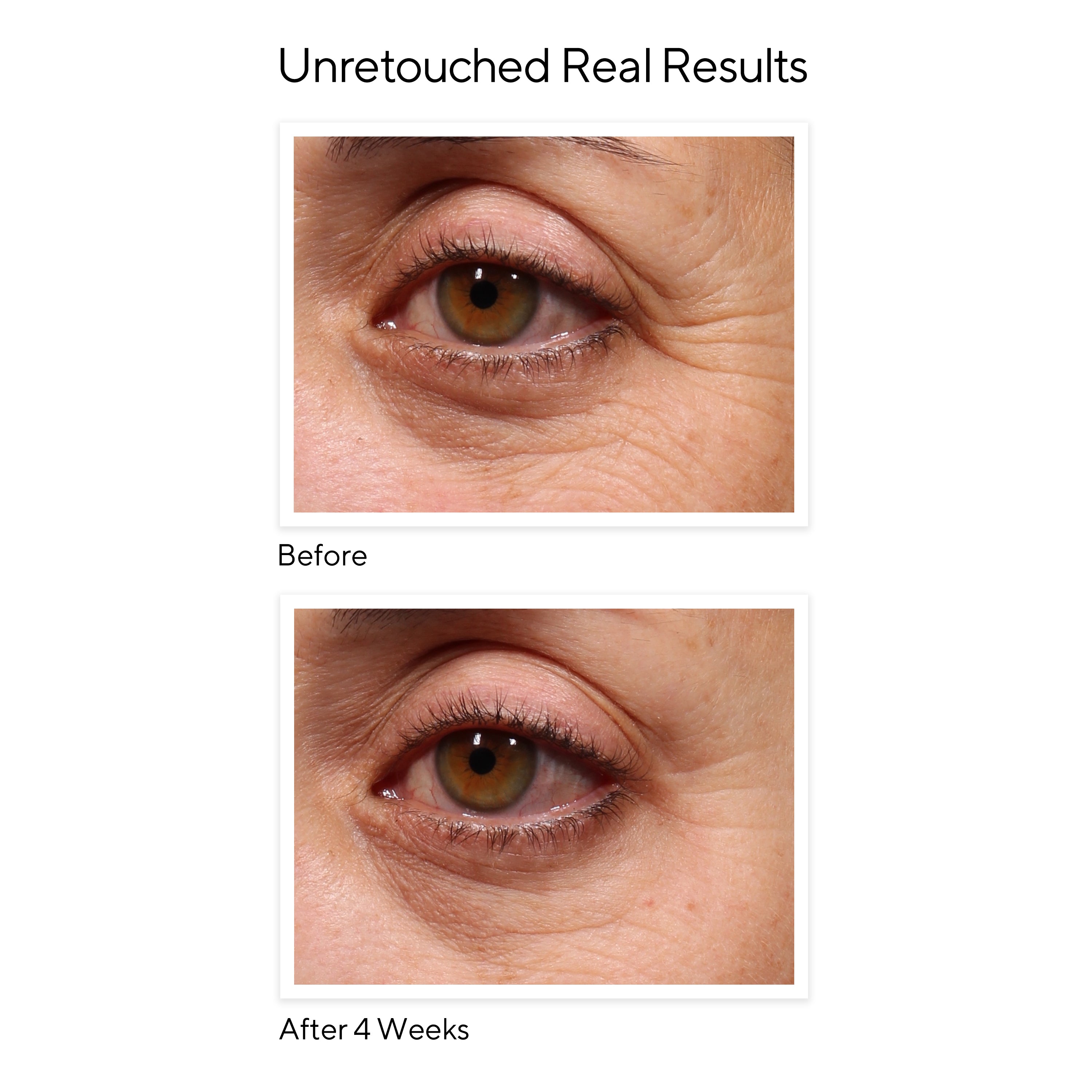 Murad Retinol Youth Renewal Eye Serum (0.5 oz)