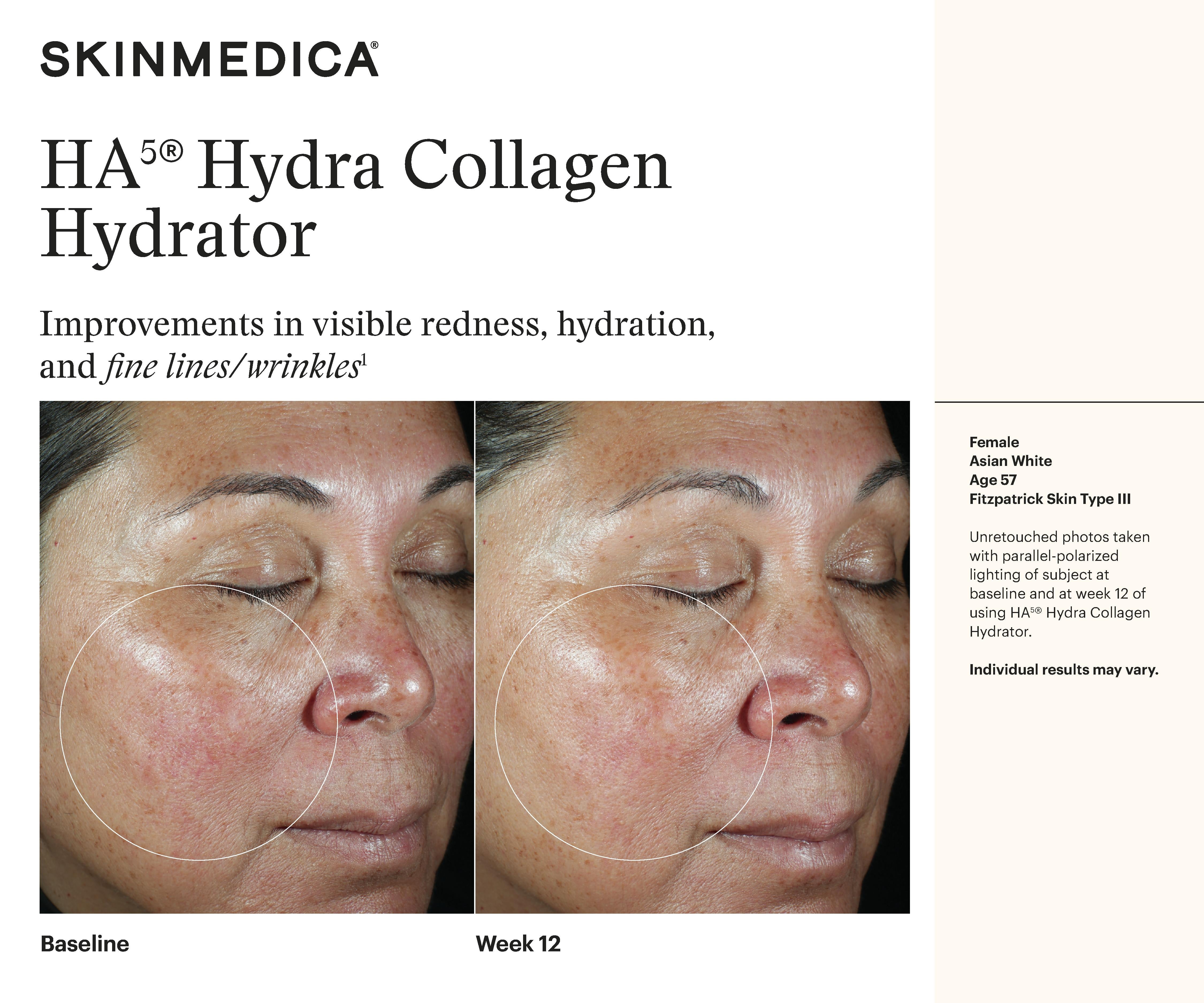 SkinMedica HA5 Hydra Collagen Replenish + Restore Hydrator (1.7 oz)