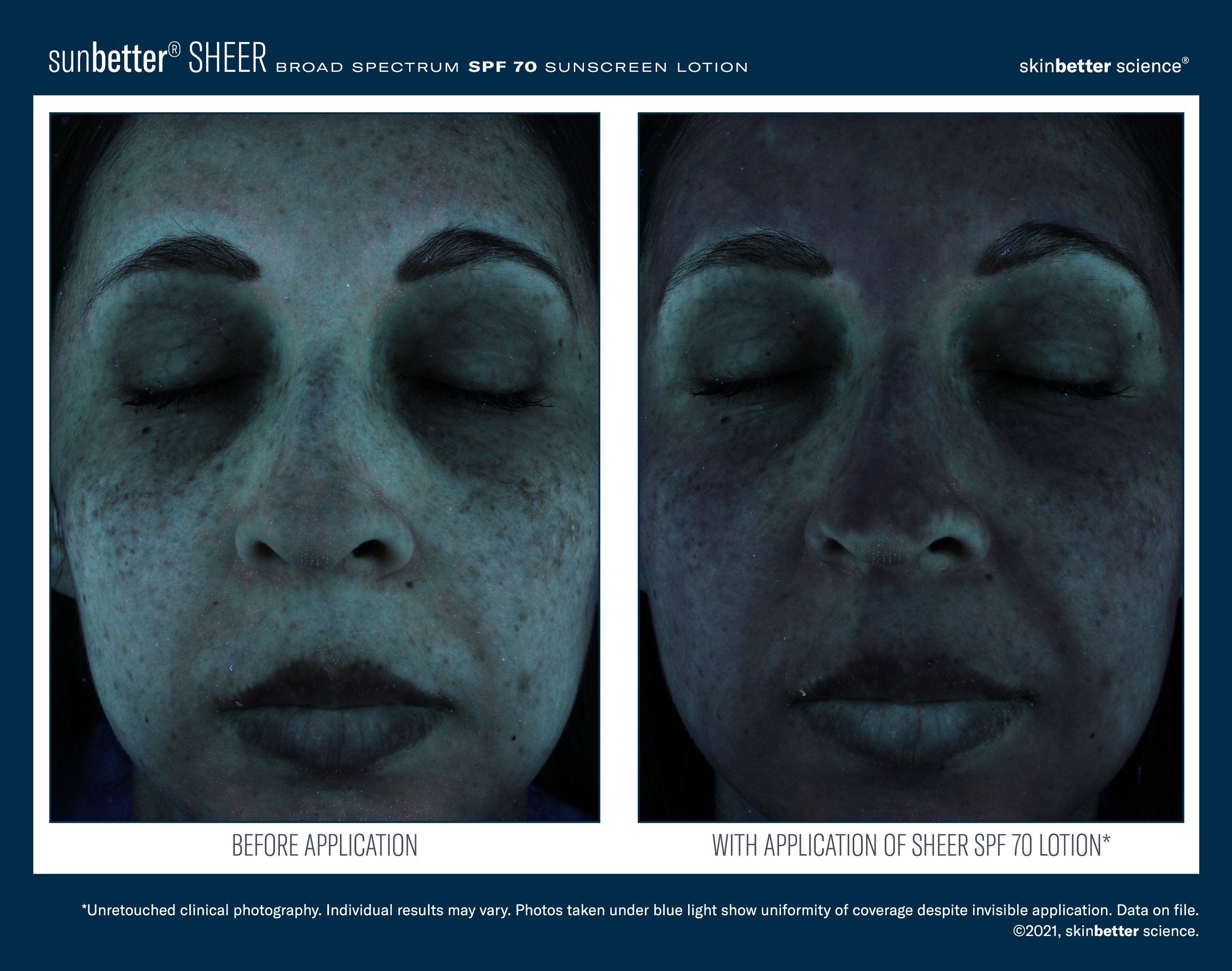 SkinBetter Science SunBetter SHEER SPF 70 Sunscreen Lotion (1.69 oz)