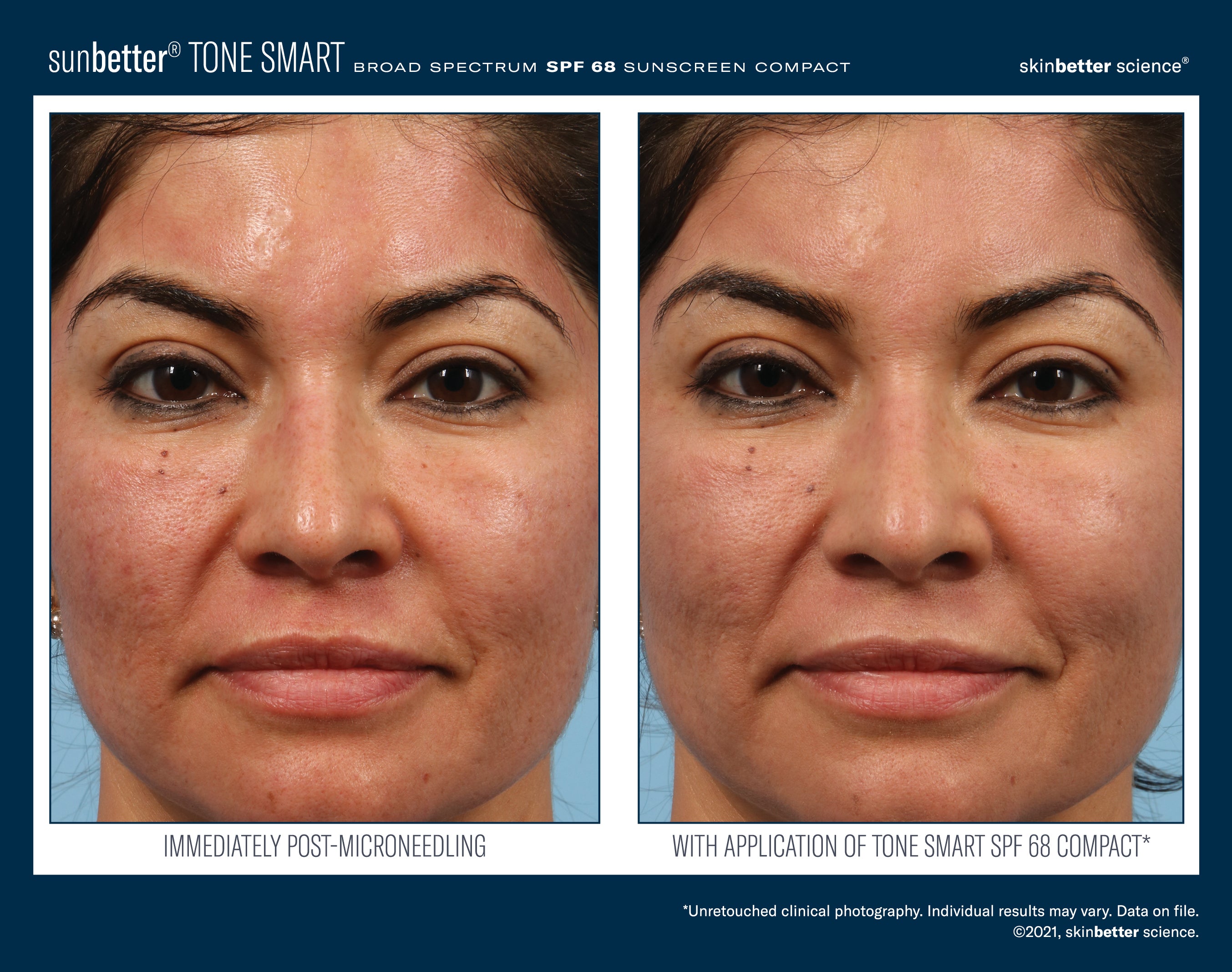 SkinBetter Science SunBetter TONE SMART SPF 68 Sunscreen Compact 12g.