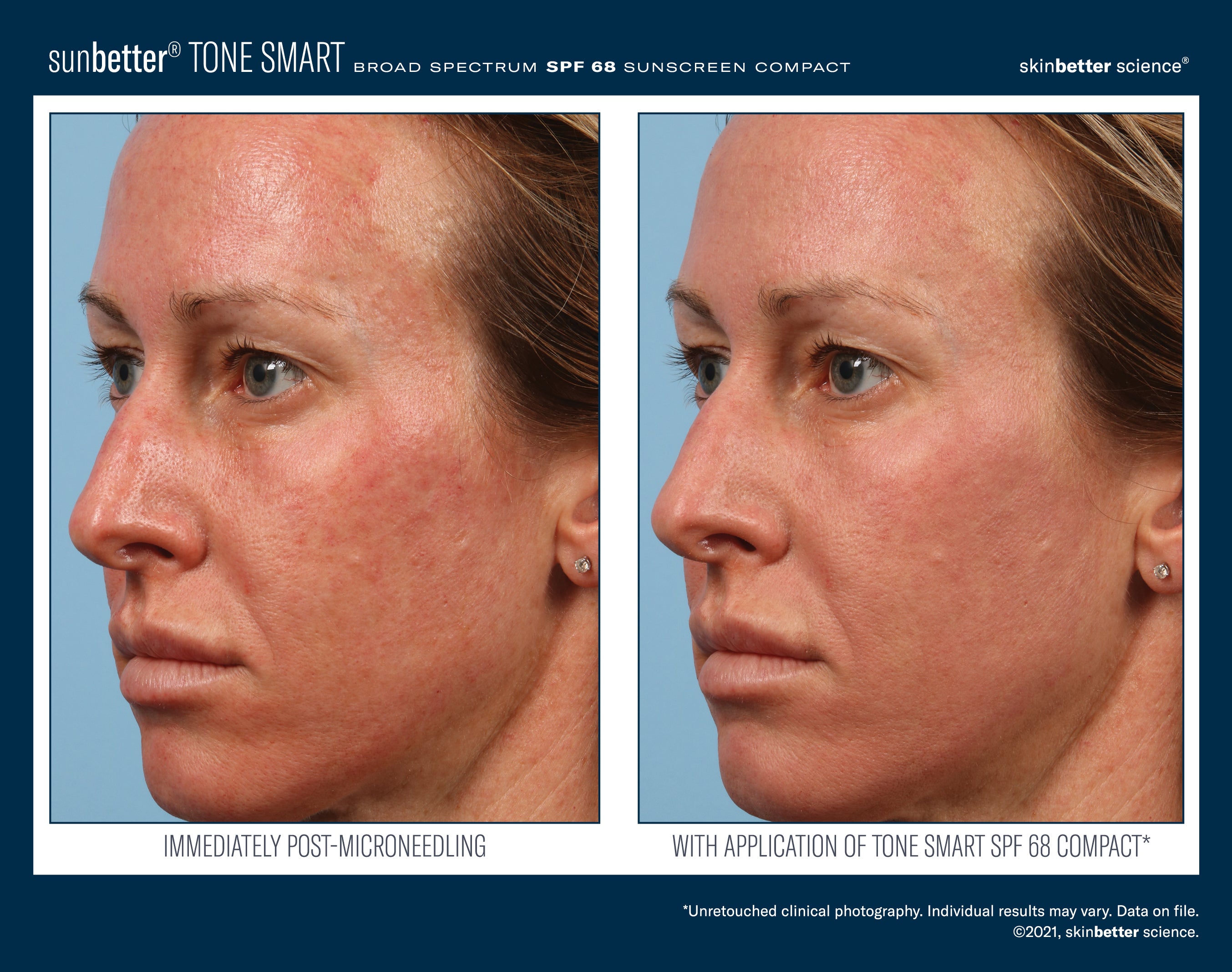 SkinBetter Science SunBetter TONE SMART SPF 68 Sunscreen Compact 12g.