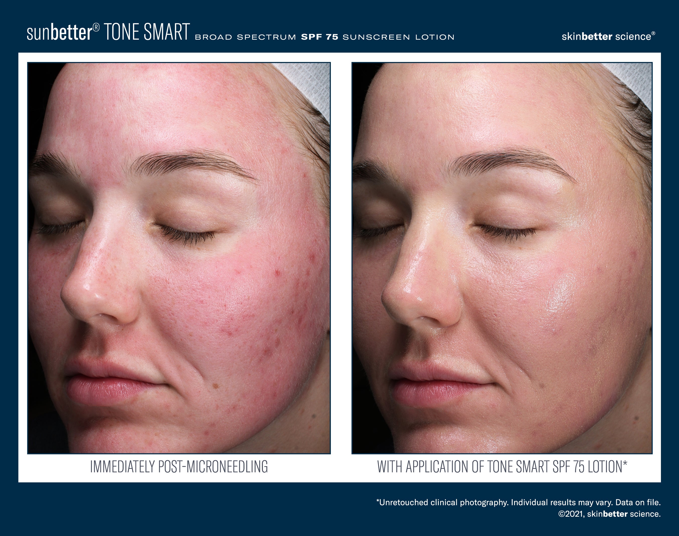 SkinBetter Science Travel Size SunBetter TONE SMART SPF 75 Sunscreen Lotion (0.5 oz).