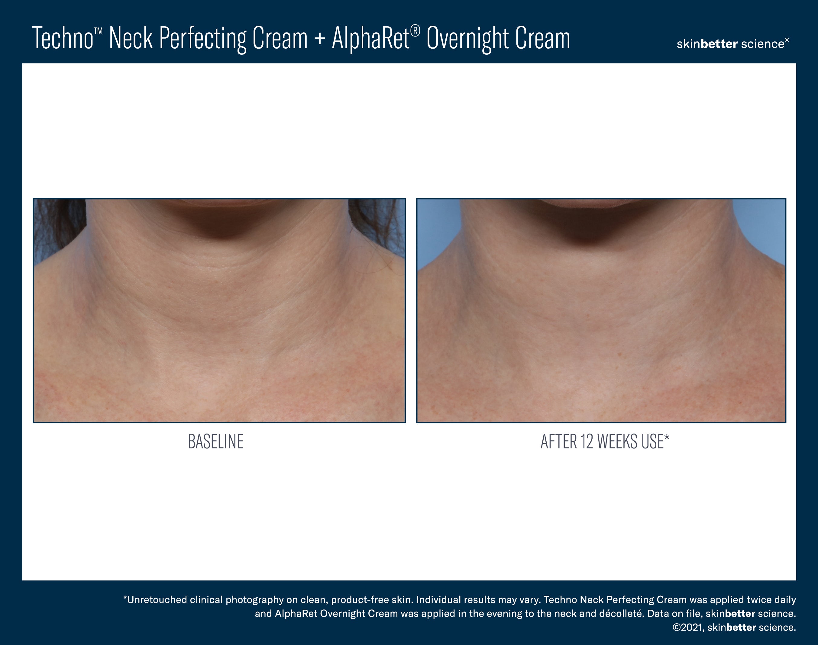 SkinBetter Science Travel Size Techno Neck Perfecting Cream (0.5 oz).