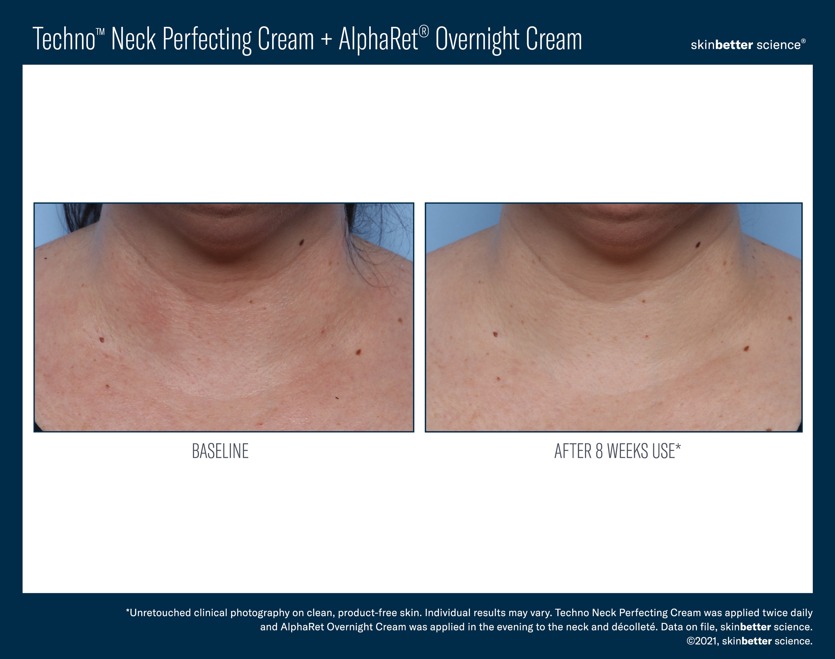 SkinBetter Science Techno Neck Perfecting Cream (1.69 oz).