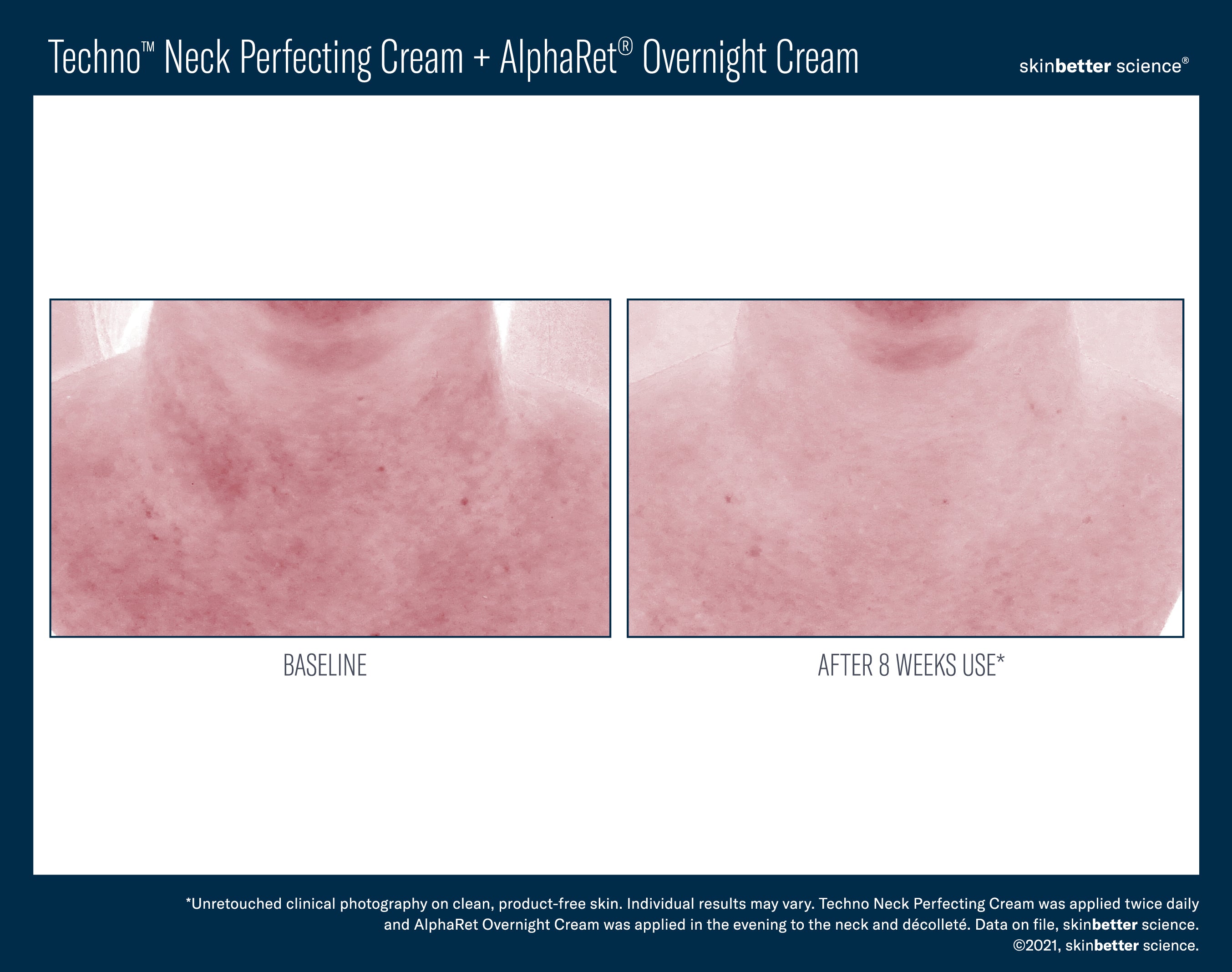 SkinBetter Science Travel Size Techno Neck Perfecting Cream (0.5 oz).