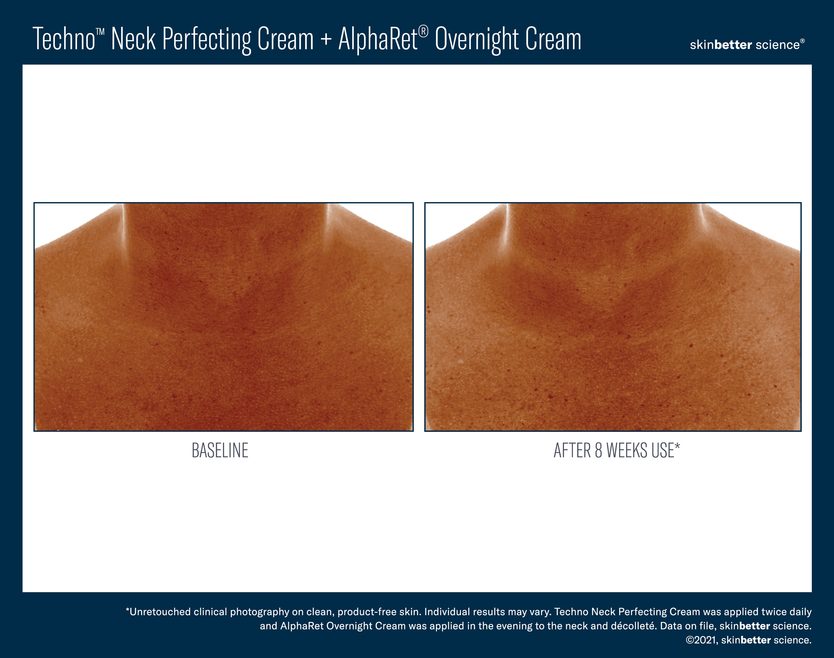 SkinBetter Science Techno Neck Perfecting Cream (1.69 oz).
