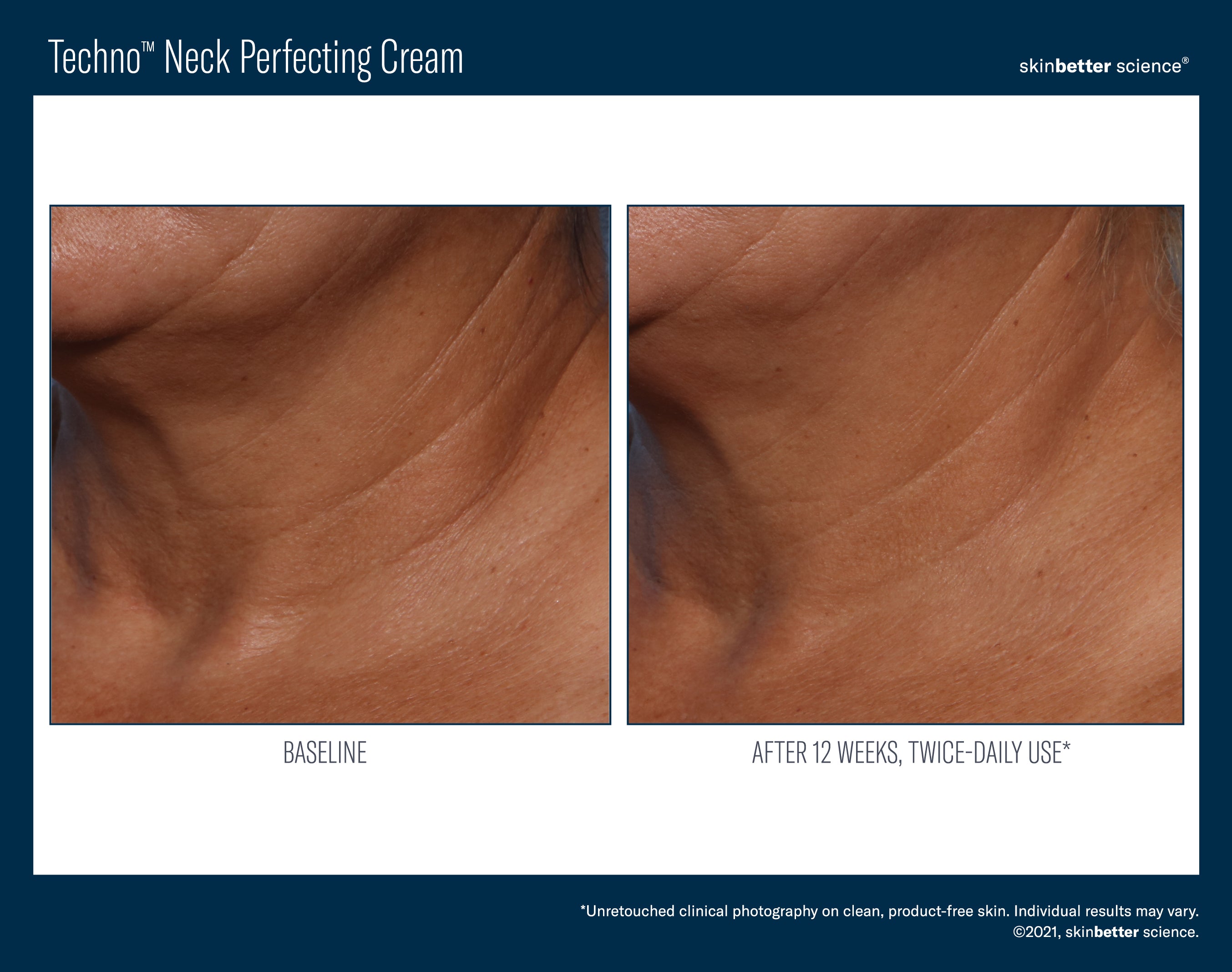 SkinBetter Science Techno Neck Perfecting Cream (1.69 oz).