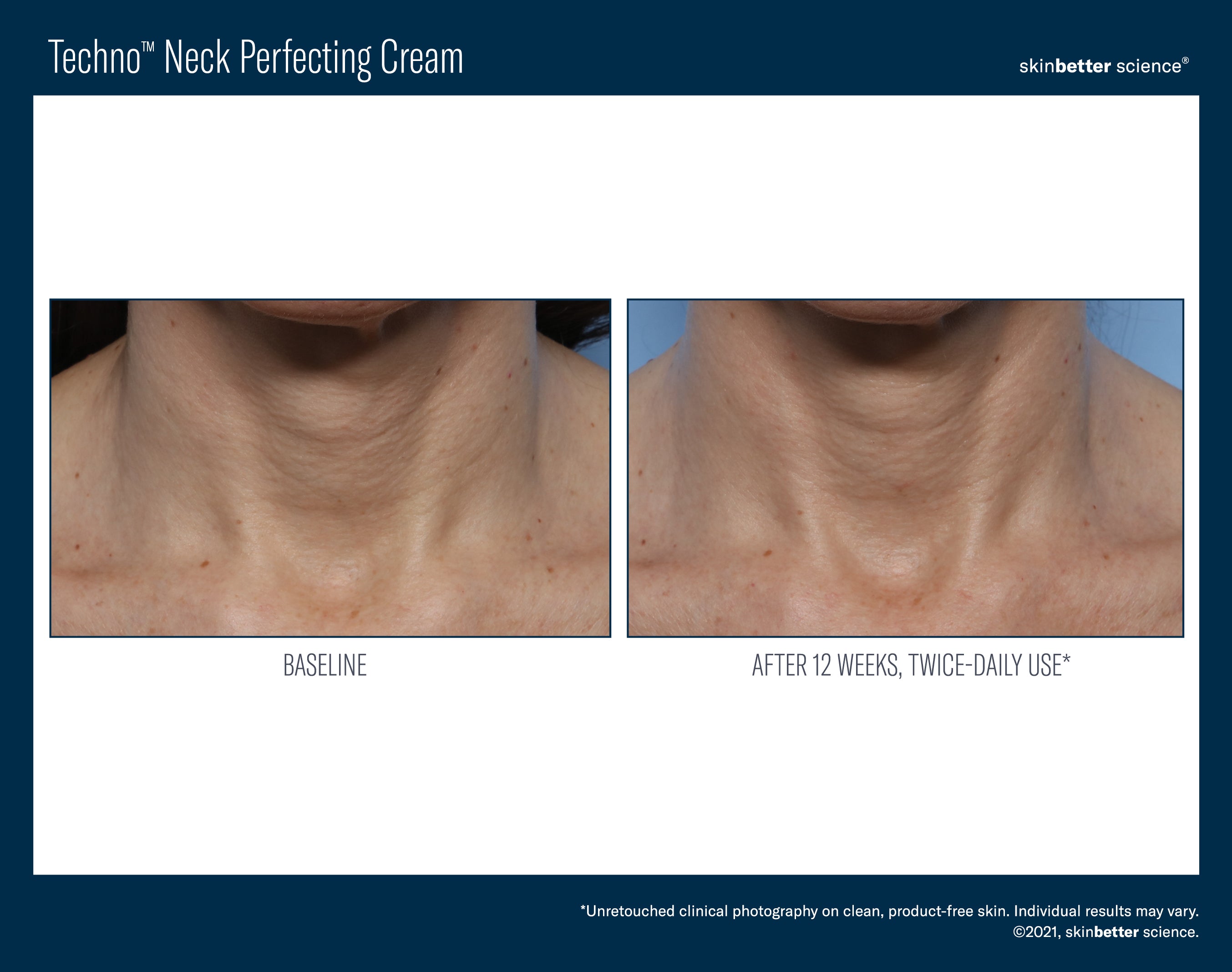 SkinBetter Science Travel Size Techno Neck Perfecting Cream (0.5 oz).