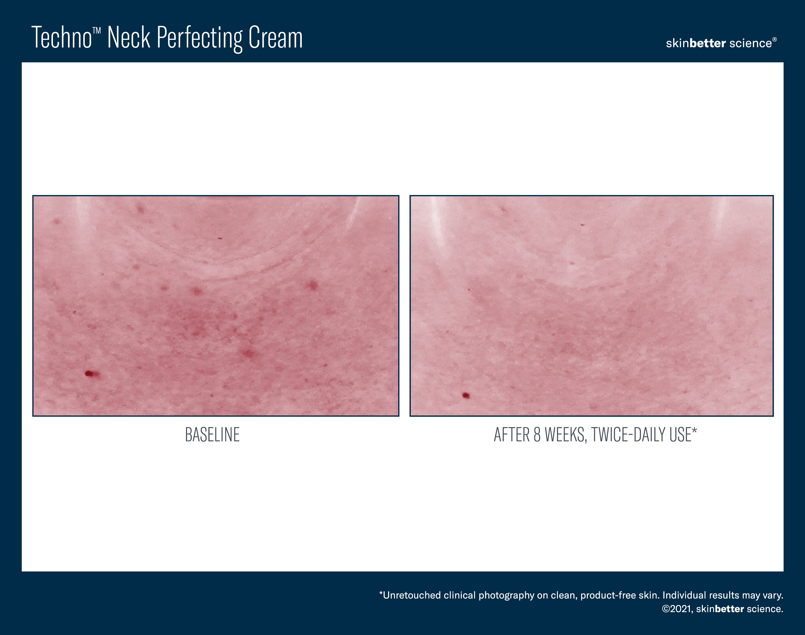 SkinBetter Science Travel Size Techno Neck Perfecting Cream (0.5 oz).