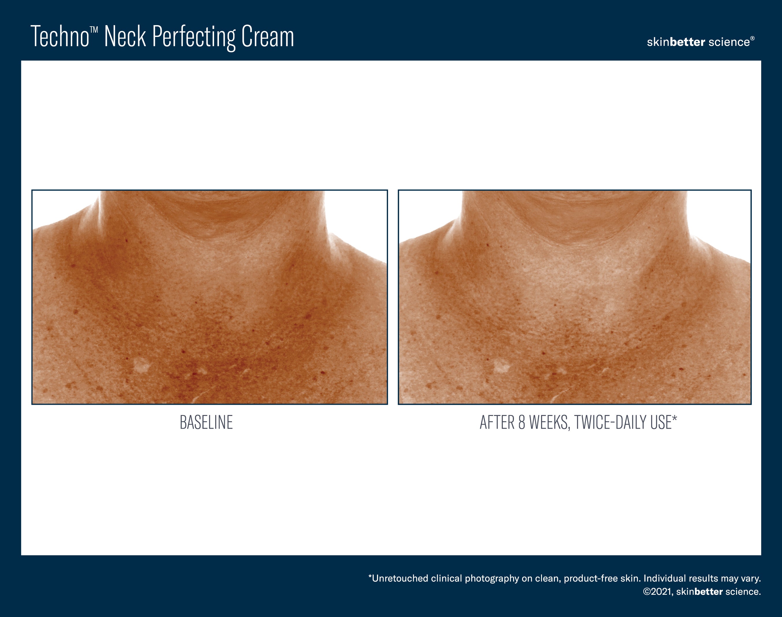 SkinBetter Science Techno Neck Perfecting Cream (1.69 oz).