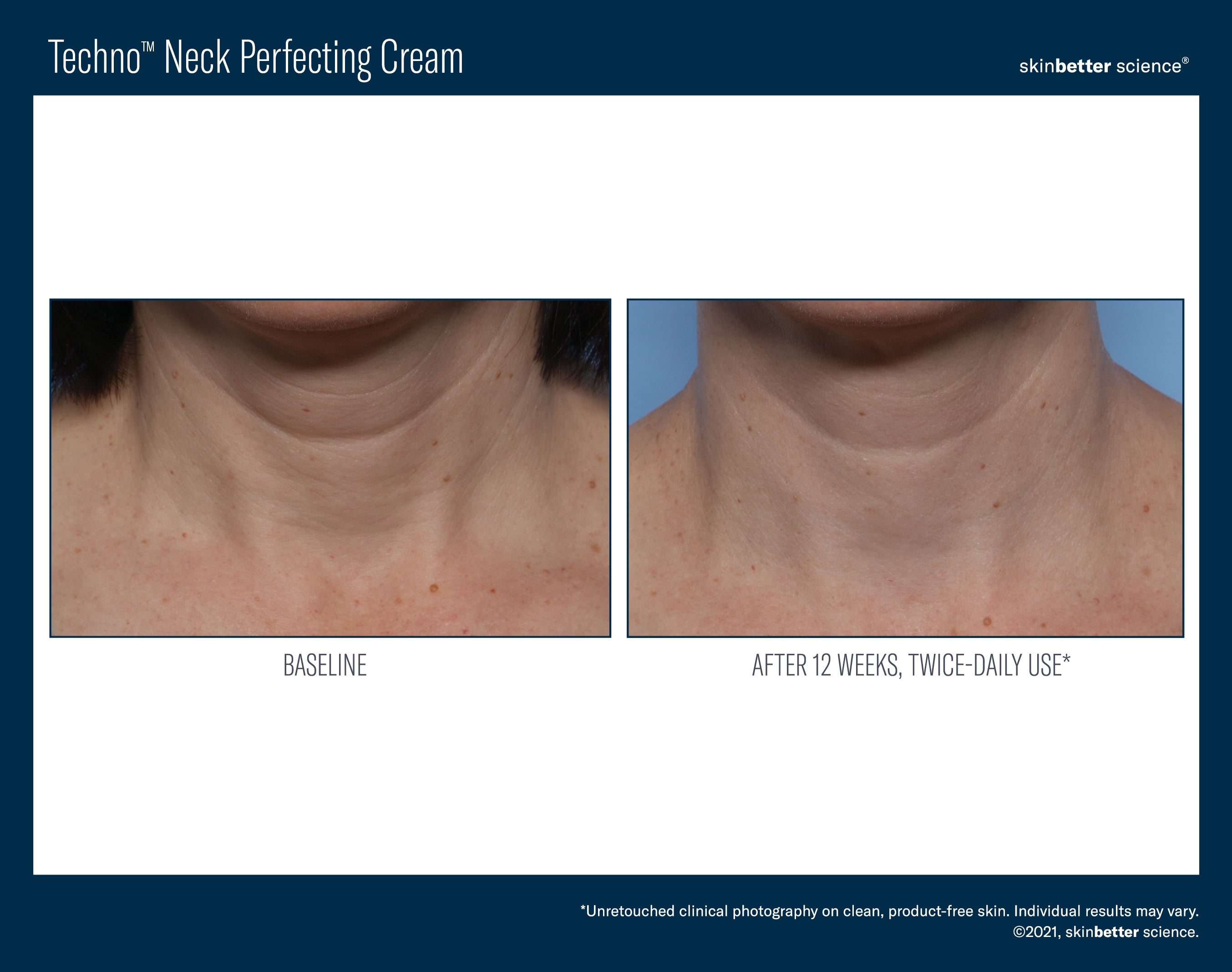 SkinBetter Science Travel Size Techno Neck Perfecting Cream (0.5 oz).