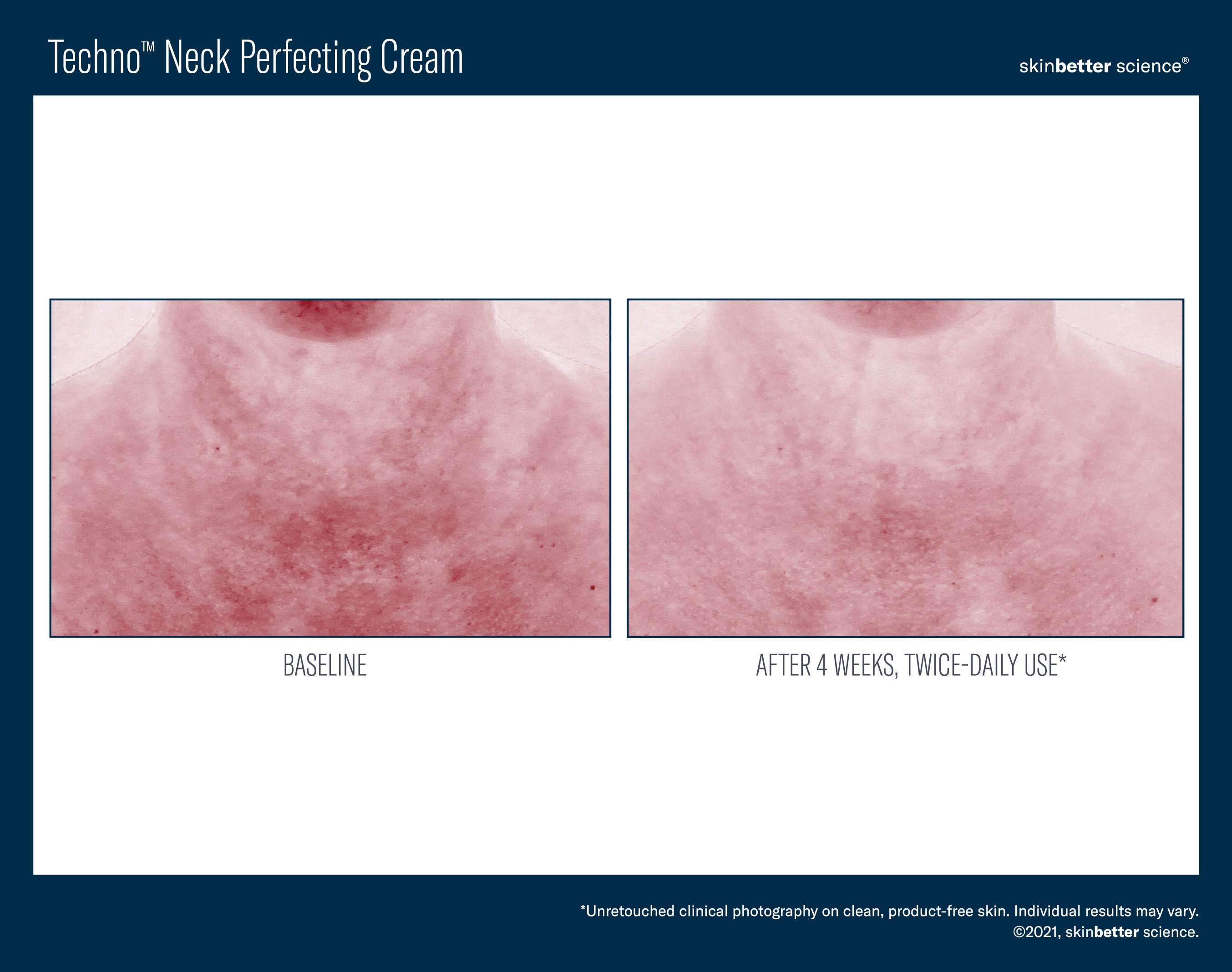SkinBetter Science Travel Size Techno Neck Perfecting Cream (0.5 oz).